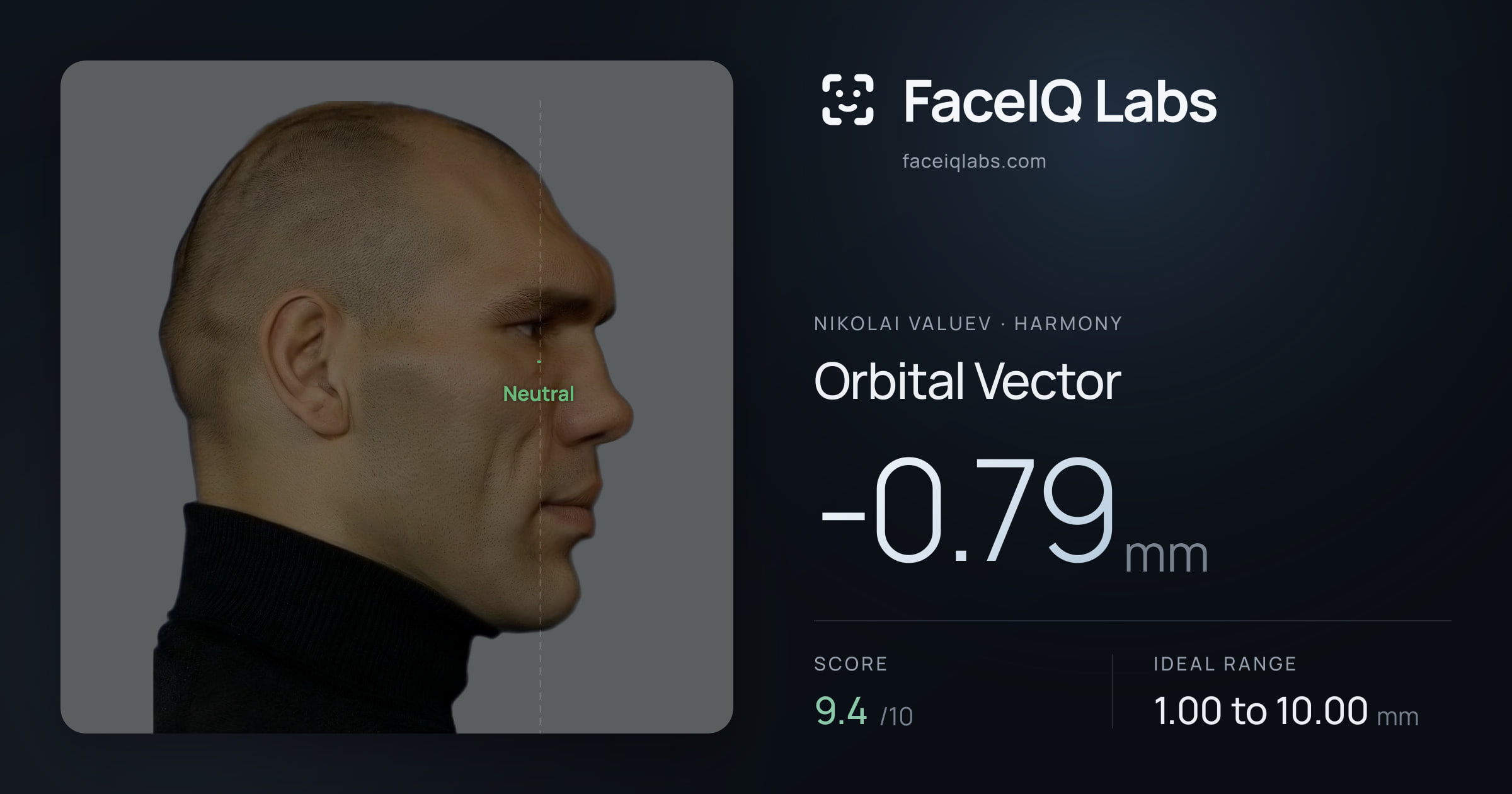 Nikolai Valuev Orbital Vector: -0.79mm, drawn on the photo
