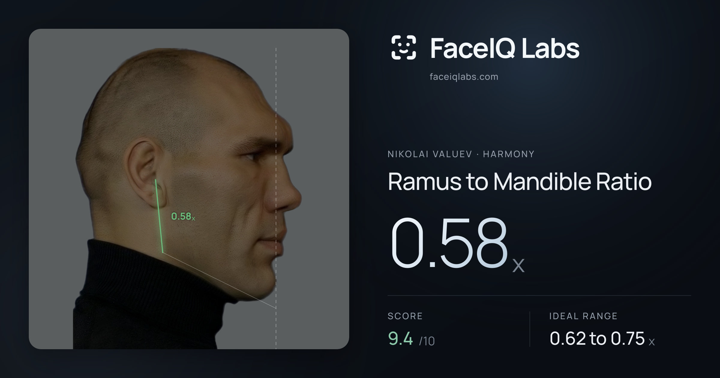 Nikolai Valuev Ramus to Mandible Ratio: 0.58x, drawn on the photo