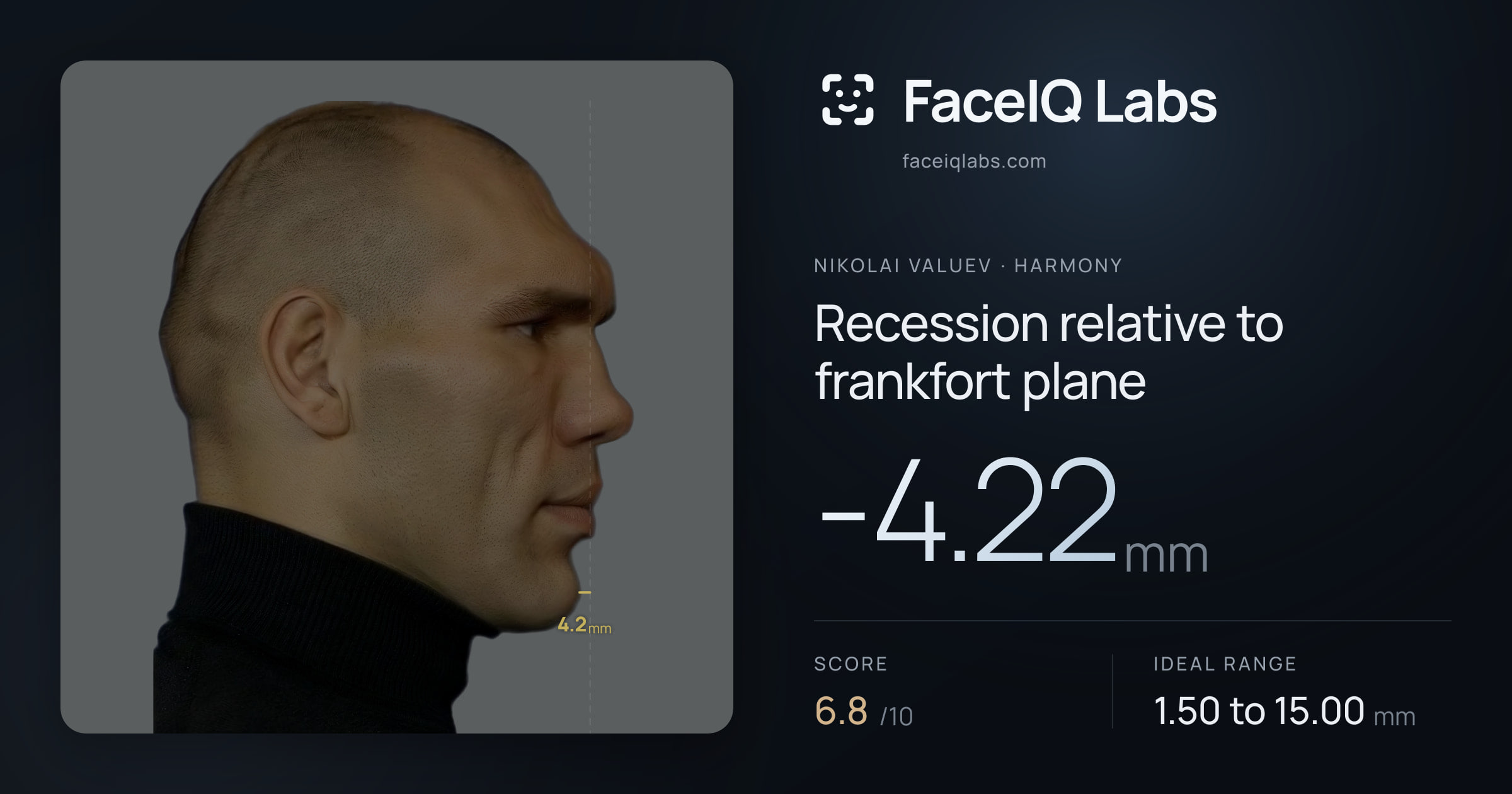Nikolai Valuev Recession relative to frankfort plane: -4.22mm, drawn on the photo