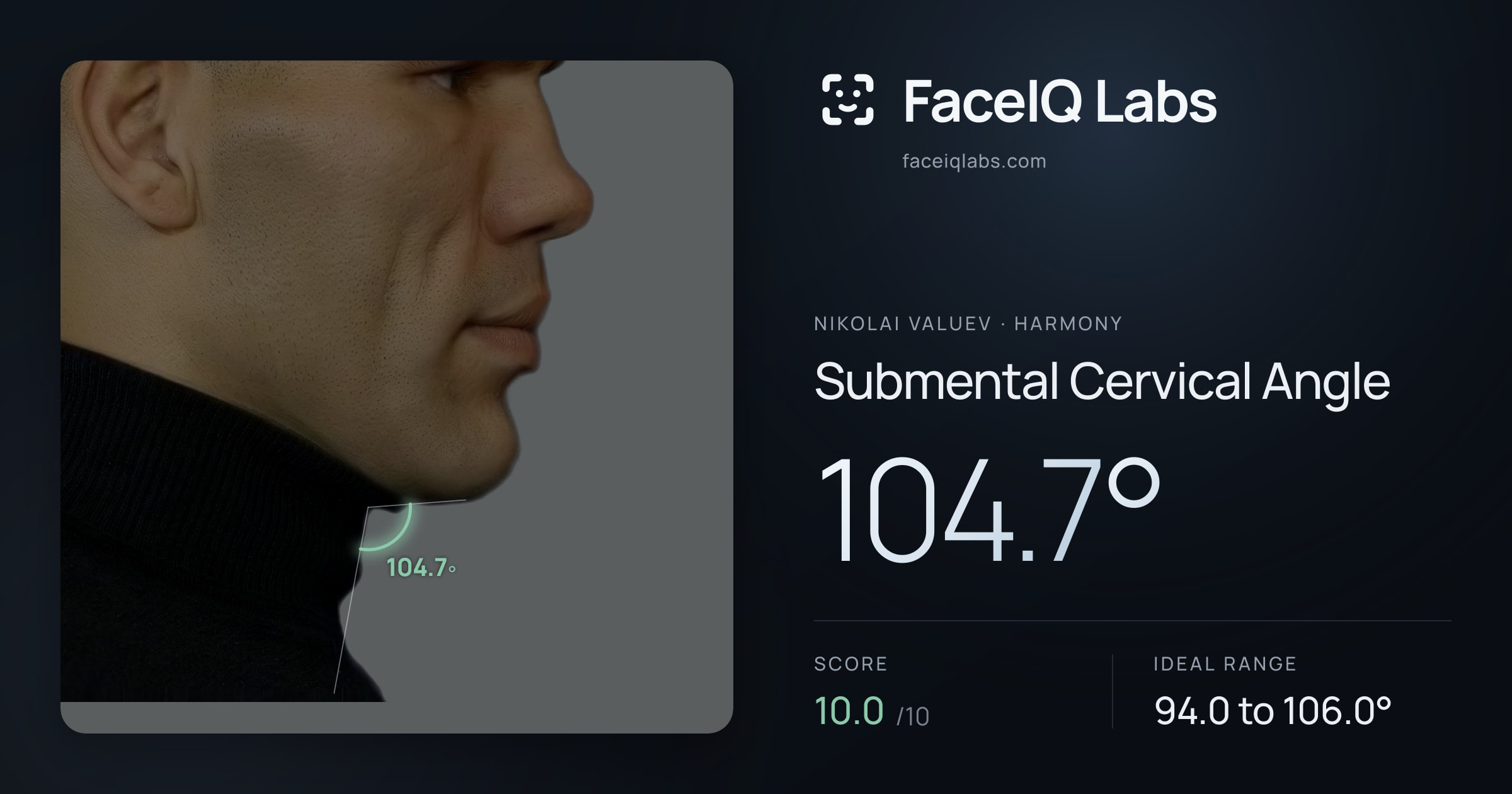 Nikolai Valuev Submental Cervical Angle: 104.7°, drawn on the photo