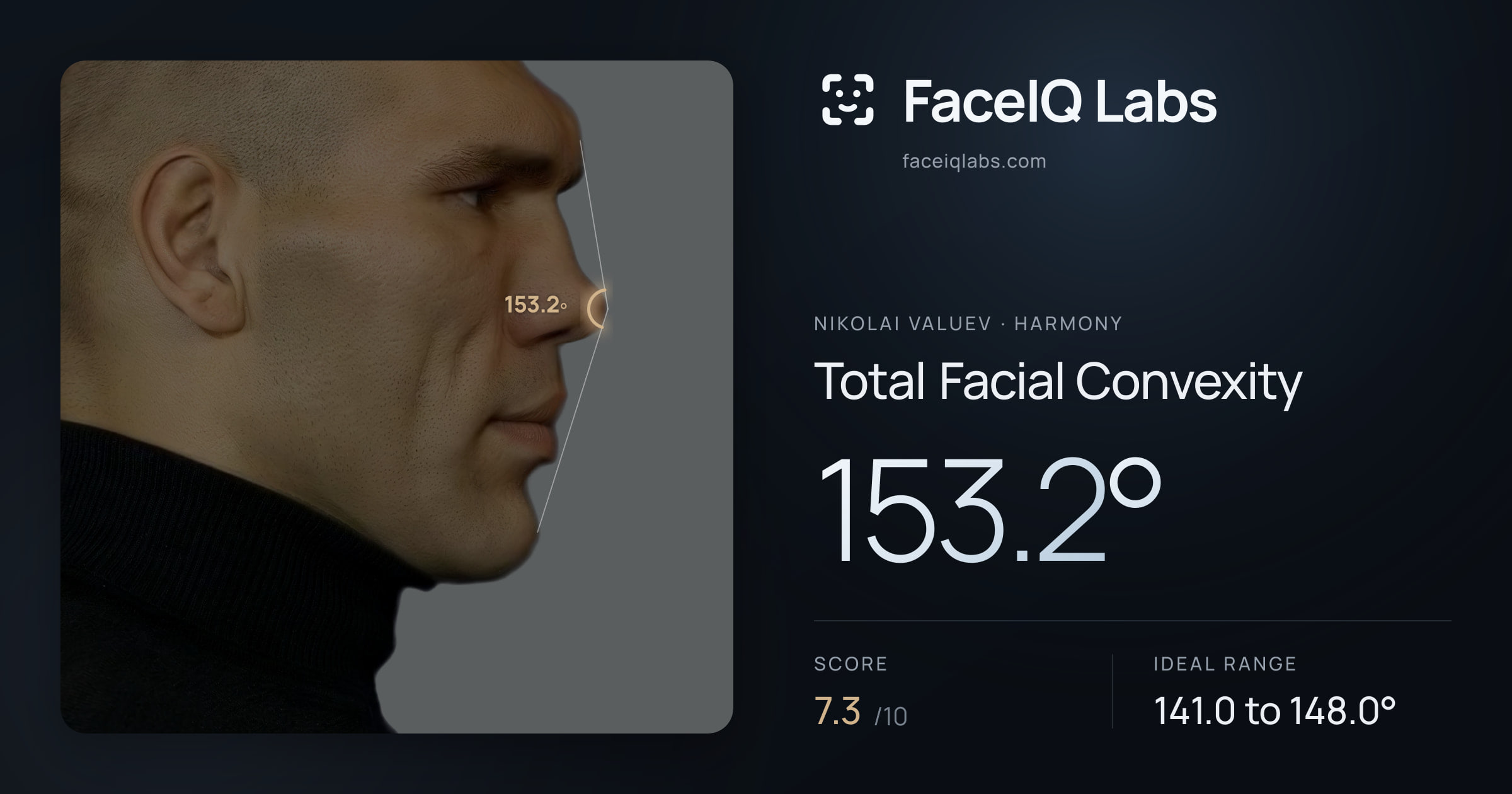 Nikolai Valuev Total Facial Convexity: 153.2°, drawn on the photo