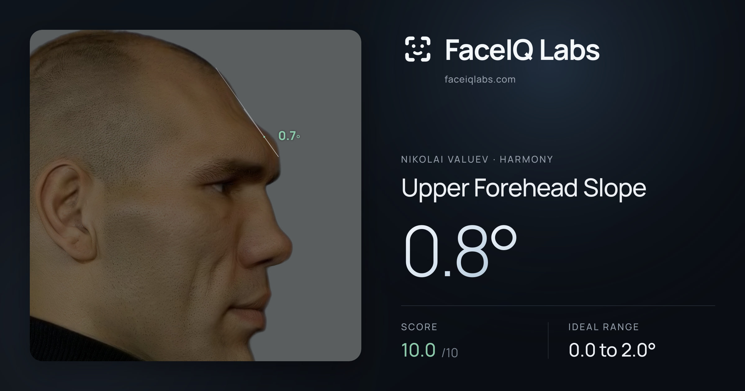 Nikolai Valuev Upper Forehead Slope: 0.8°, drawn on the photo