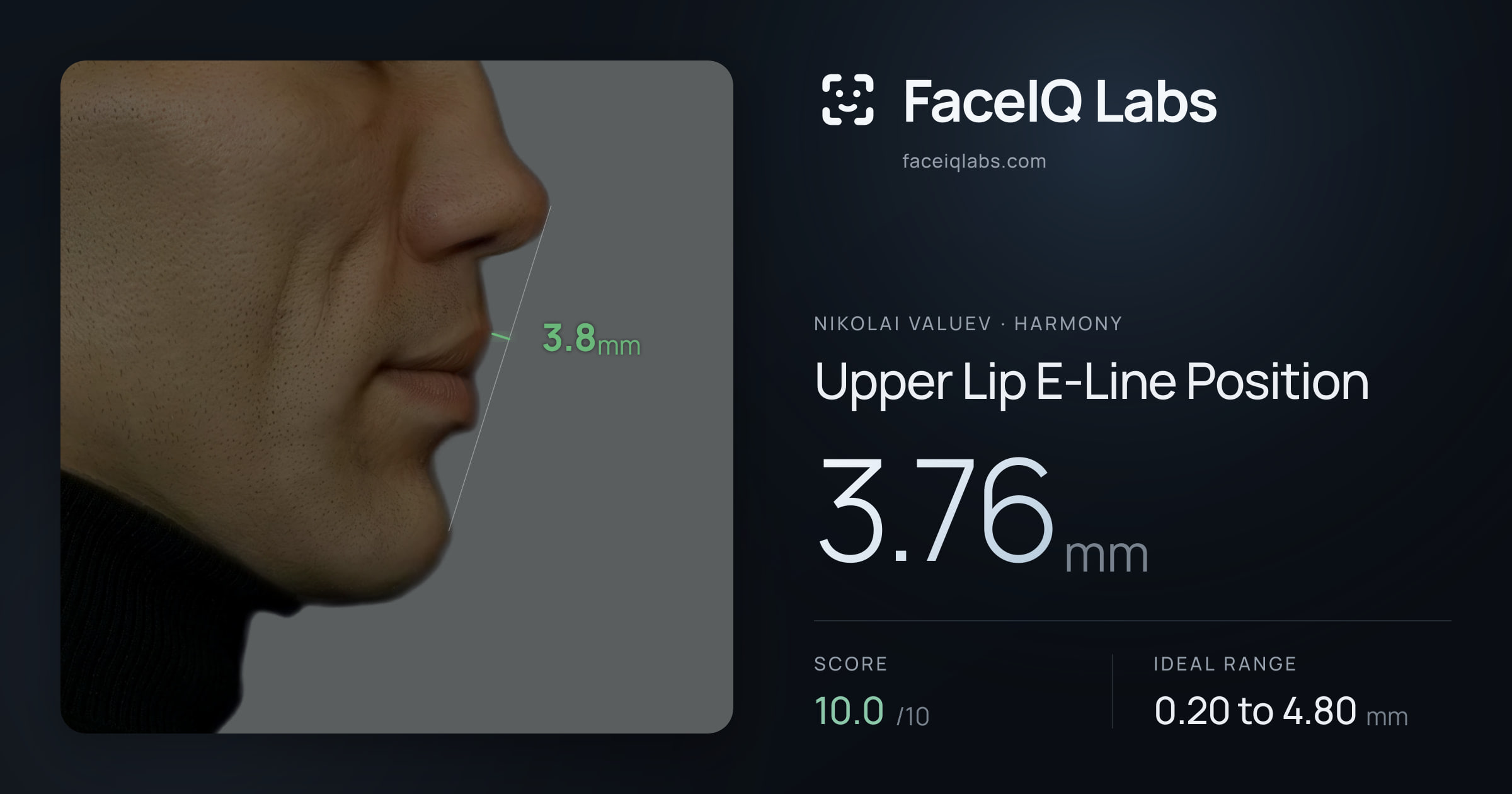 Nikolai Valuev Upper Lip E-Line Position: 3.76mm, drawn on the photo