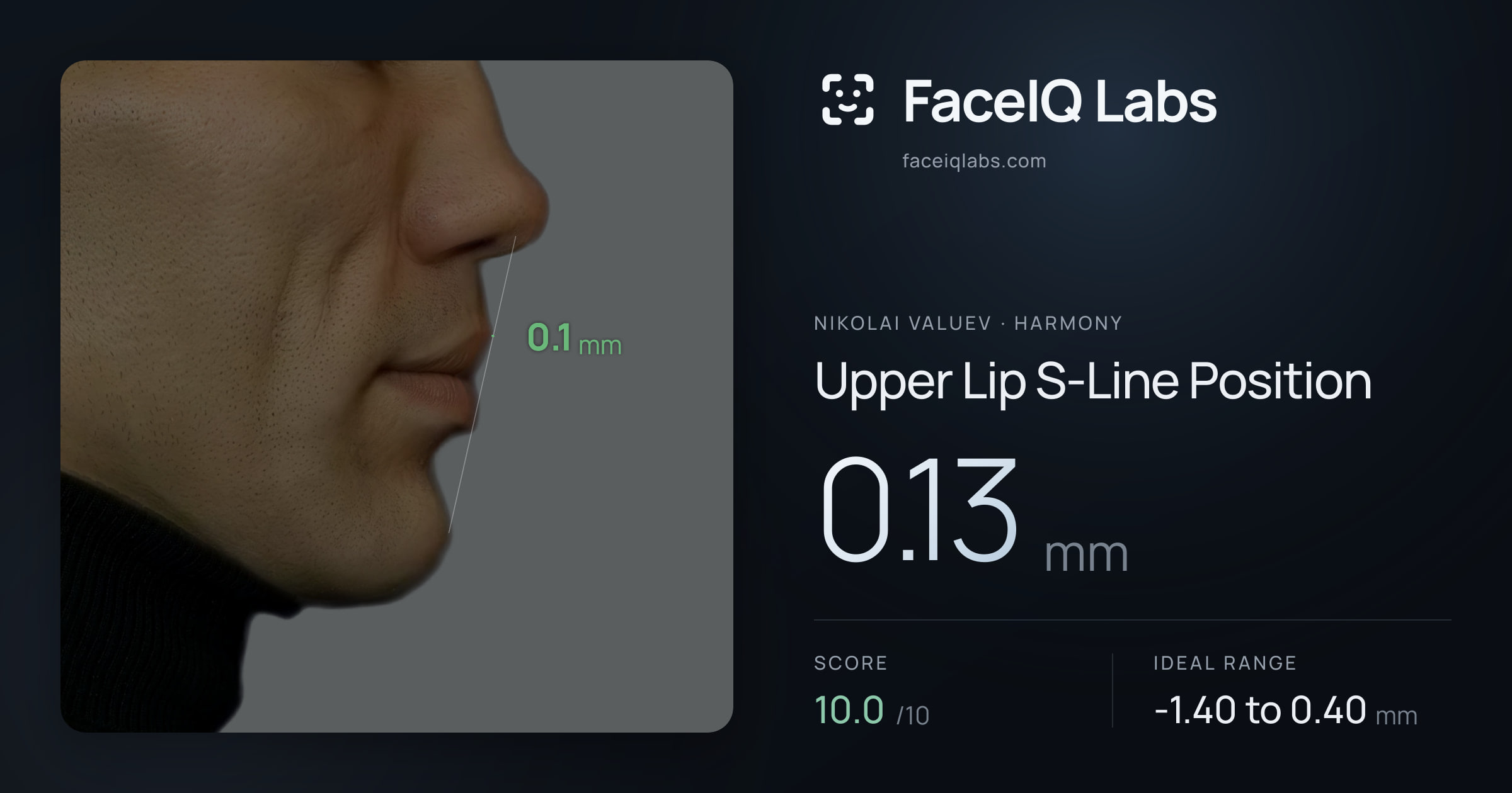 Nikolai Valuev Upper Lip S-Line Position: 0.13mm, drawn on the photo