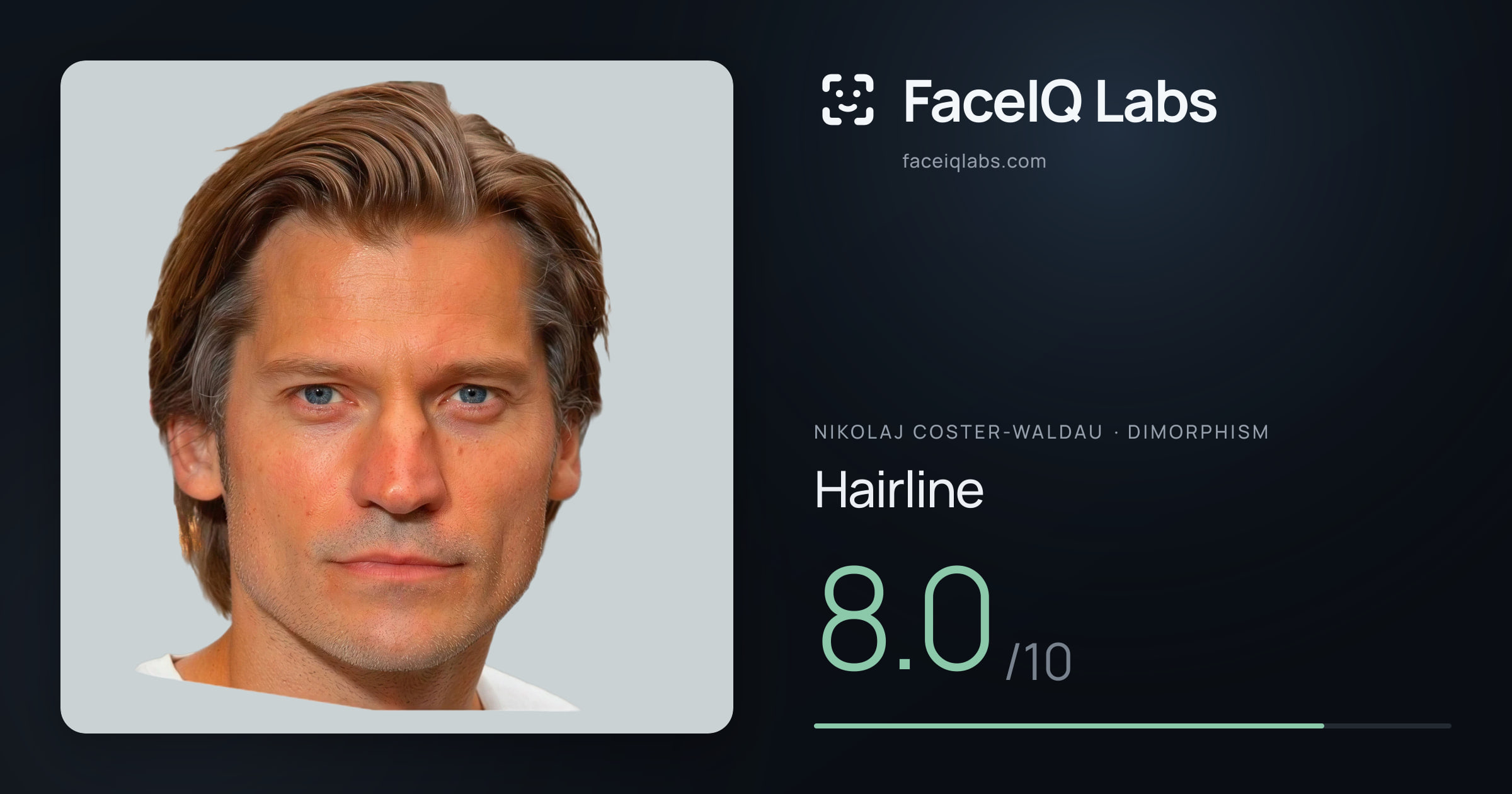 Nikolaj Coster-Waldau Hairline: 8.0/10, drawn on the photo