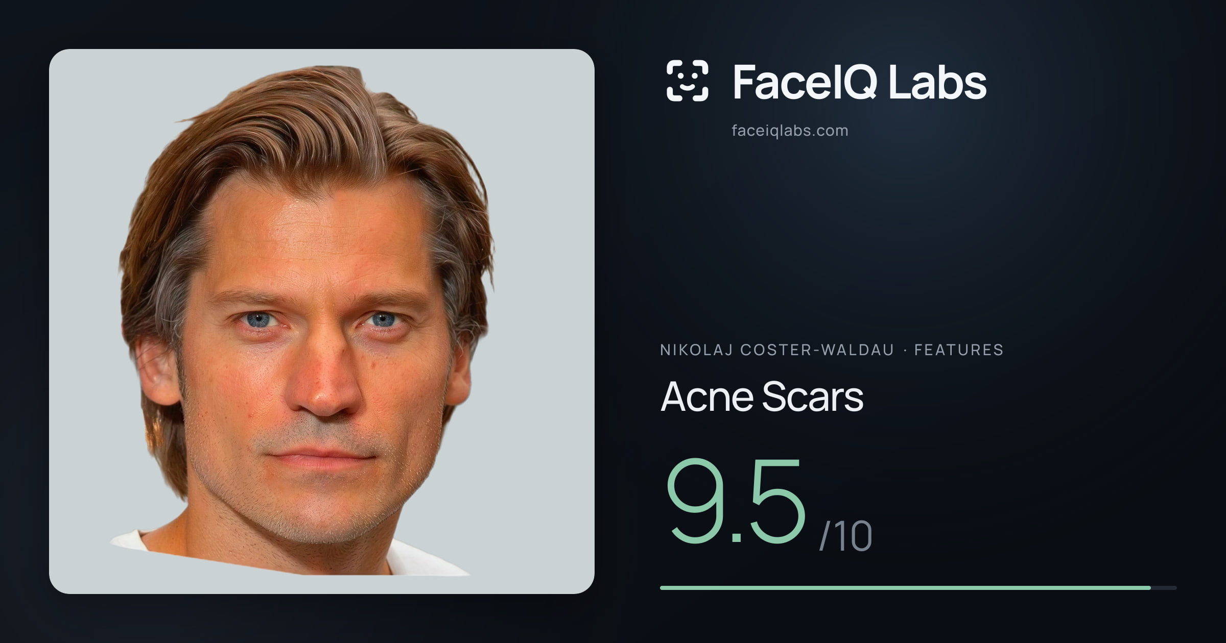 Nikolaj Coster-Waldau Acne Scars: 9.5/10, drawn on the photo
