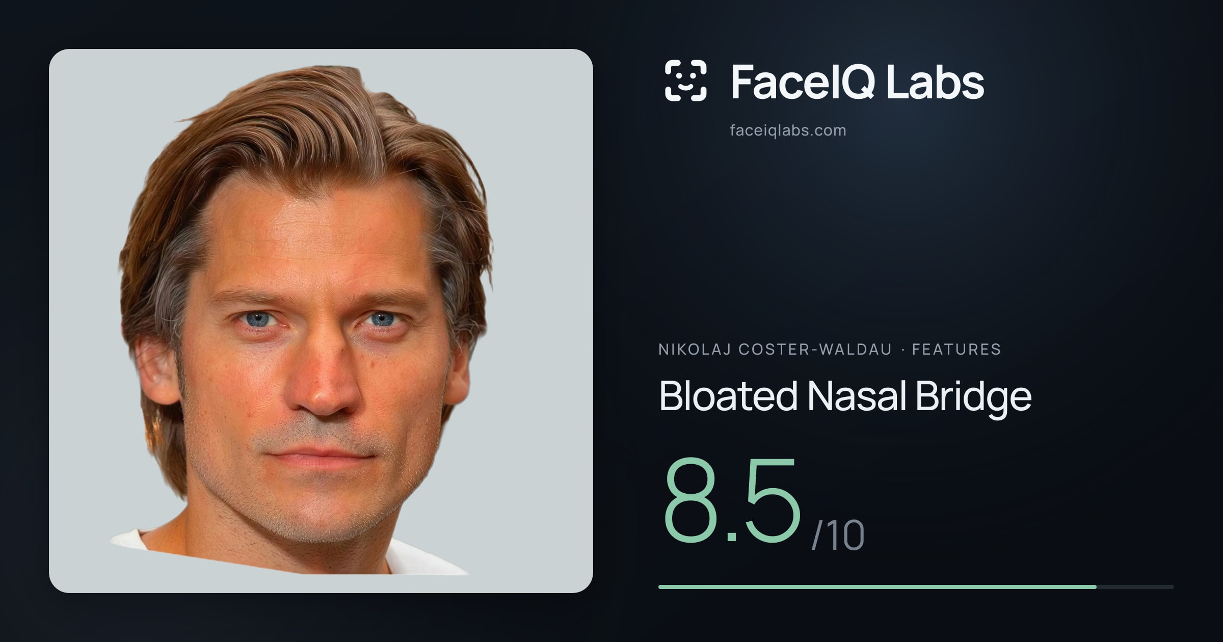 Nikolaj Coster-Waldau Bloated Nasal Bridge: 8.5/10, drawn on the photo