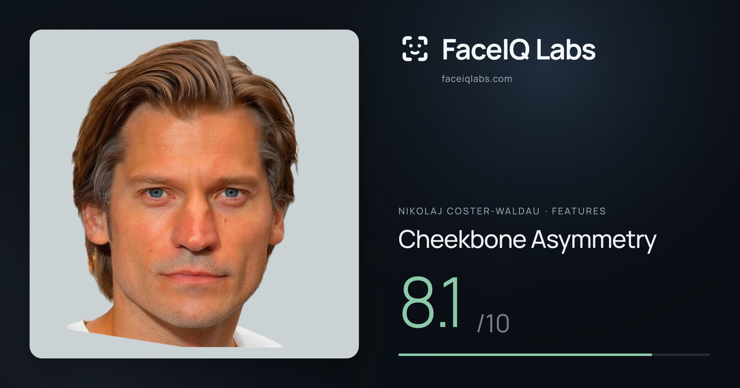 Nikolaj Coster-Waldau Cheekbone Asymmetry: 8.1/10, drawn on the photo