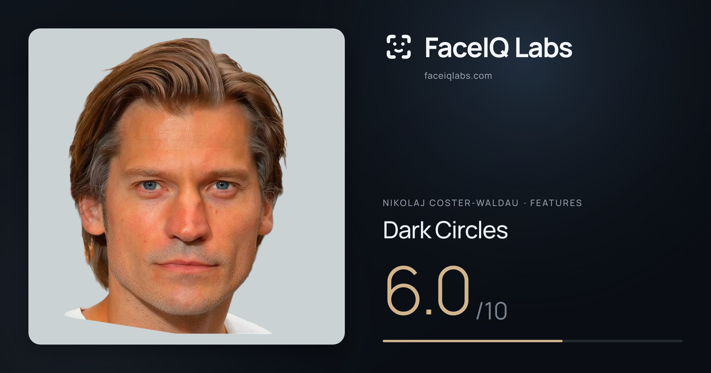 Nikolaj Coster-Waldau Dark Circles: 6.0/10, drawn on the photo