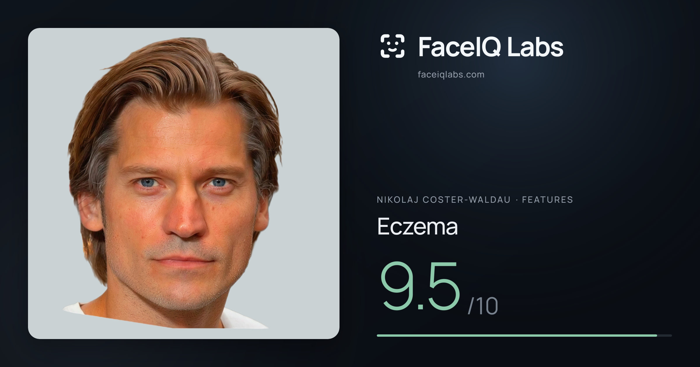 Nikolaj Coster-Waldau Eczema: 9.5/10, drawn on the photo