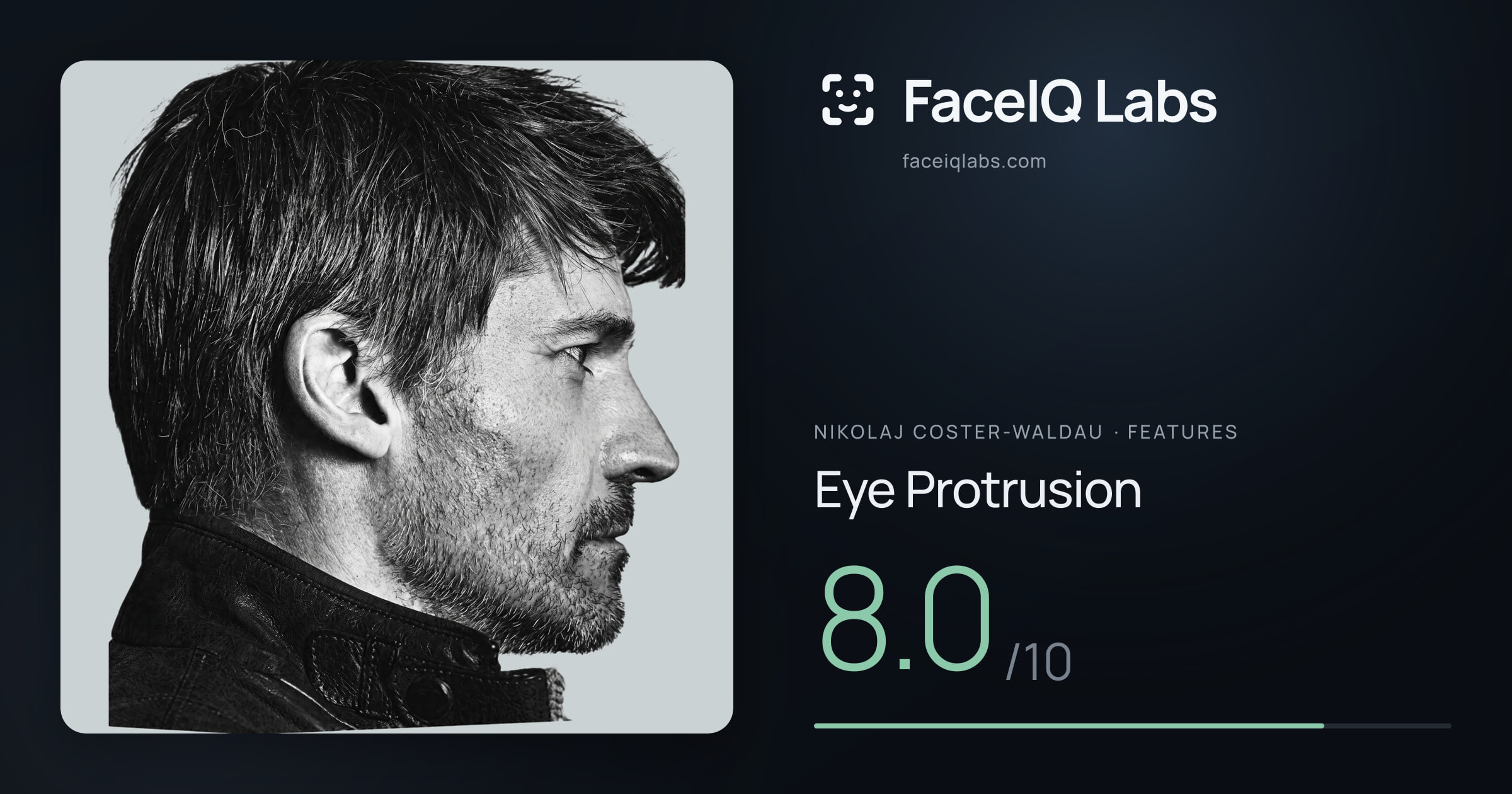 Nikolaj Coster-Waldau Eye Protrusion: 8.0/10, drawn on the photo