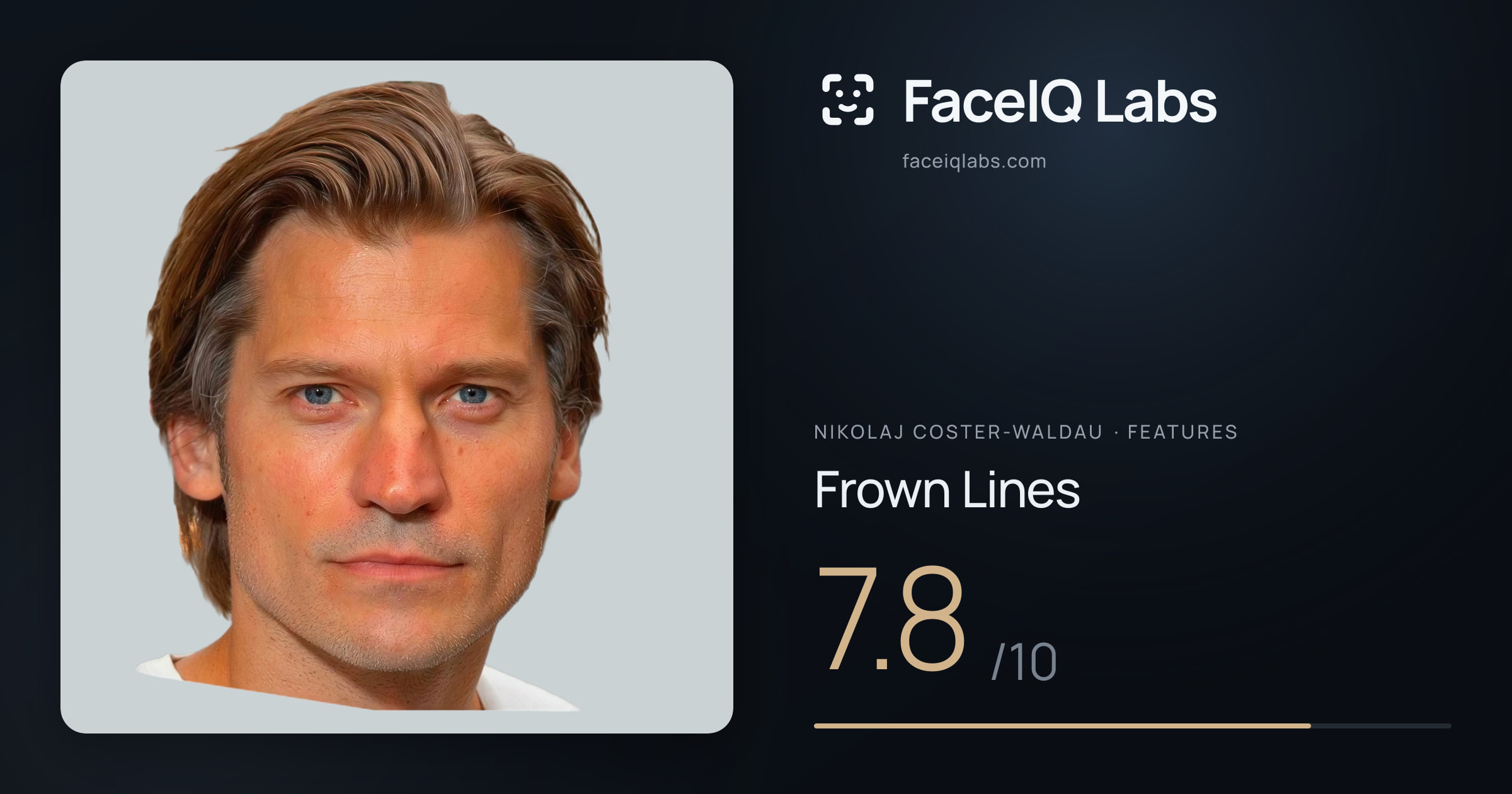 Nikolaj Coster-Waldau Frown Lines: 7.8/10, drawn on the photo