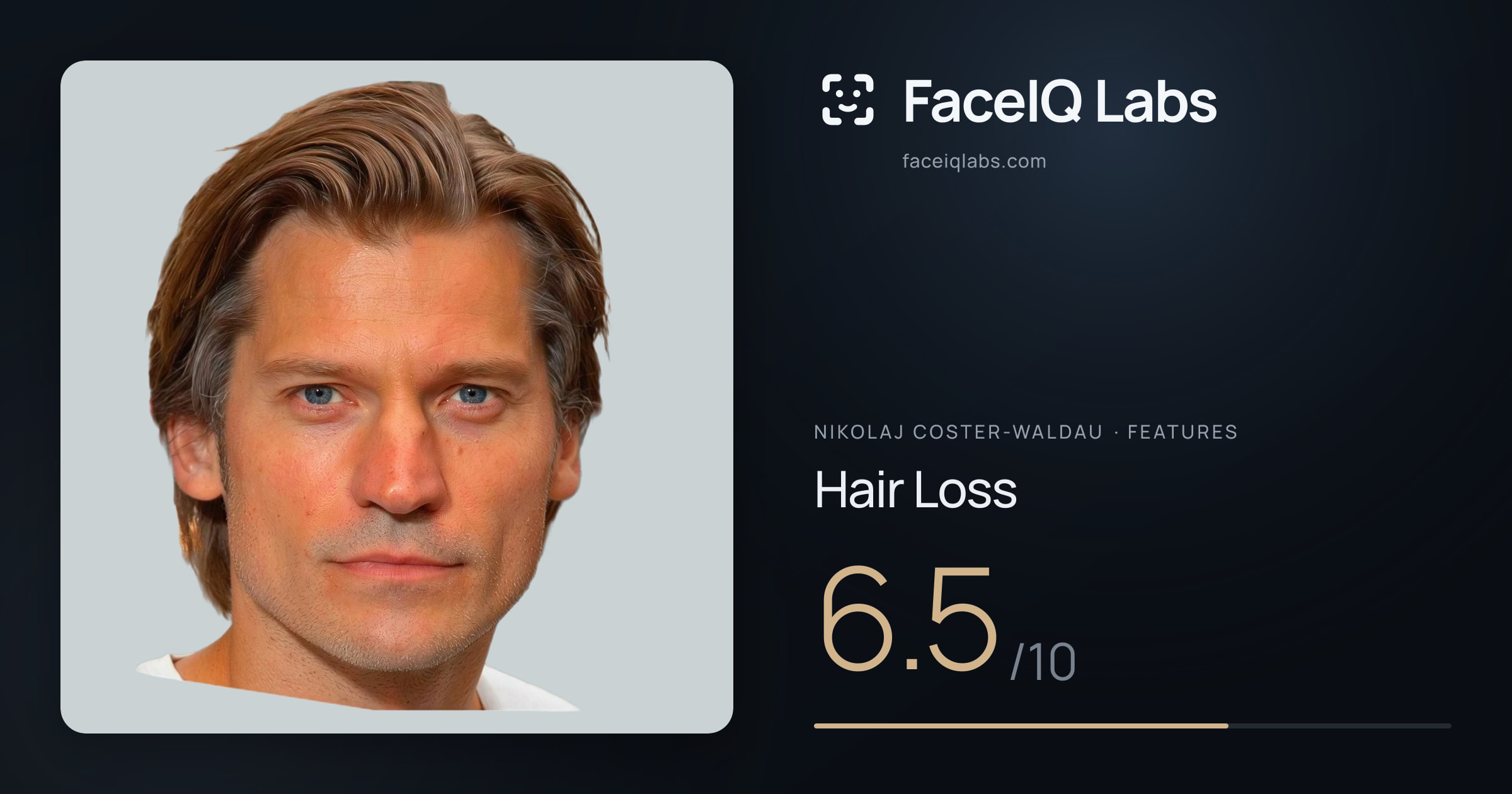 Nikolaj Coster-Waldau Hair Loss: 6.5/10, drawn on the photo