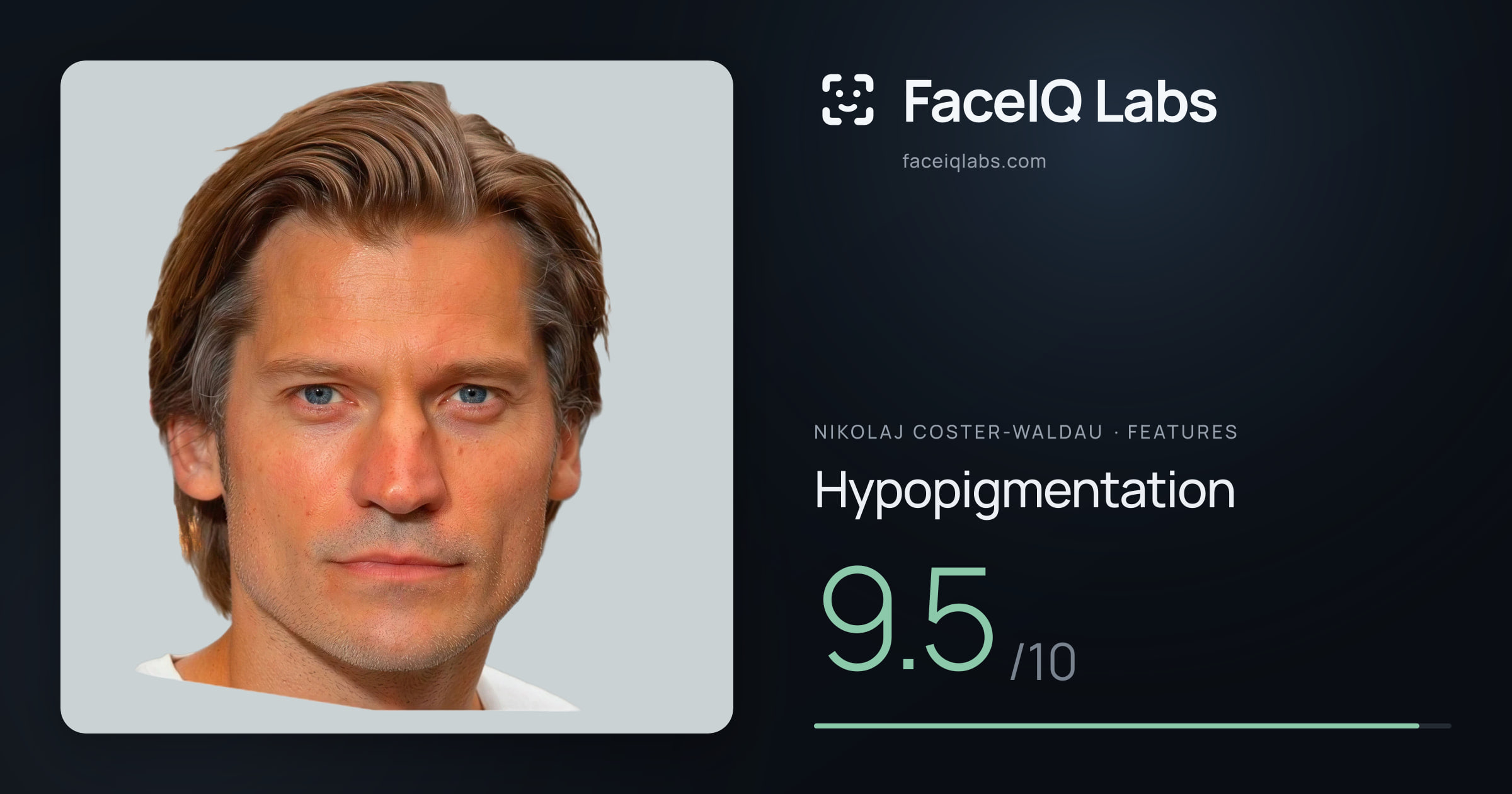 Nikolaj Coster-Waldau Hypopigmentation: 9.5/10, drawn on the photo