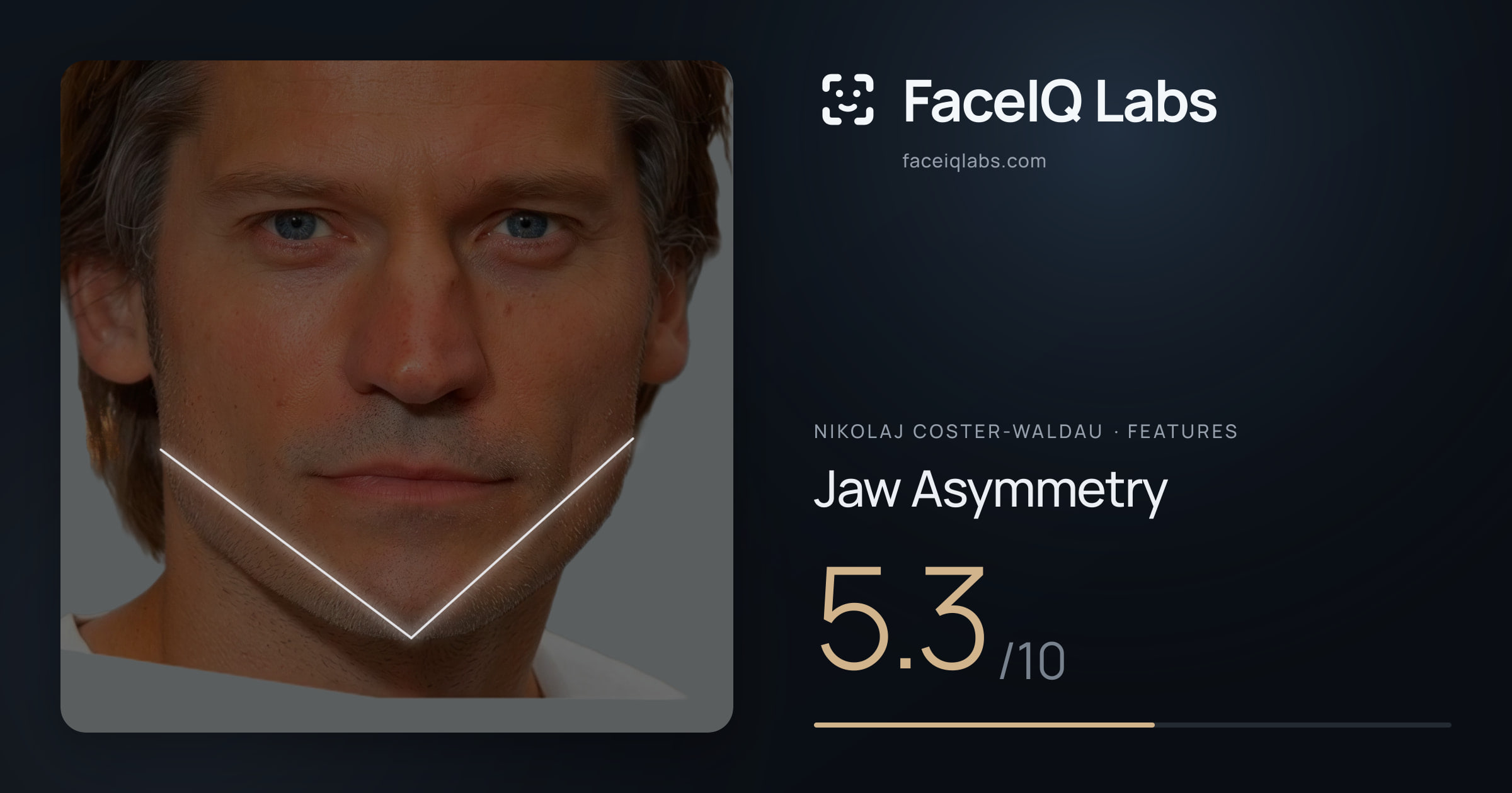 Nikolaj Coster-Waldau Jaw Asymmetry: 5.3/10, drawn on the photo