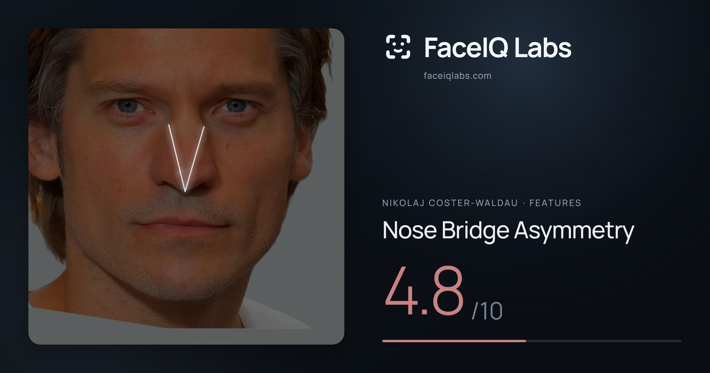 Nikolaj Coster-Waldau Nose Bridge Asymmetry: 4.8/10, drawn on the photo