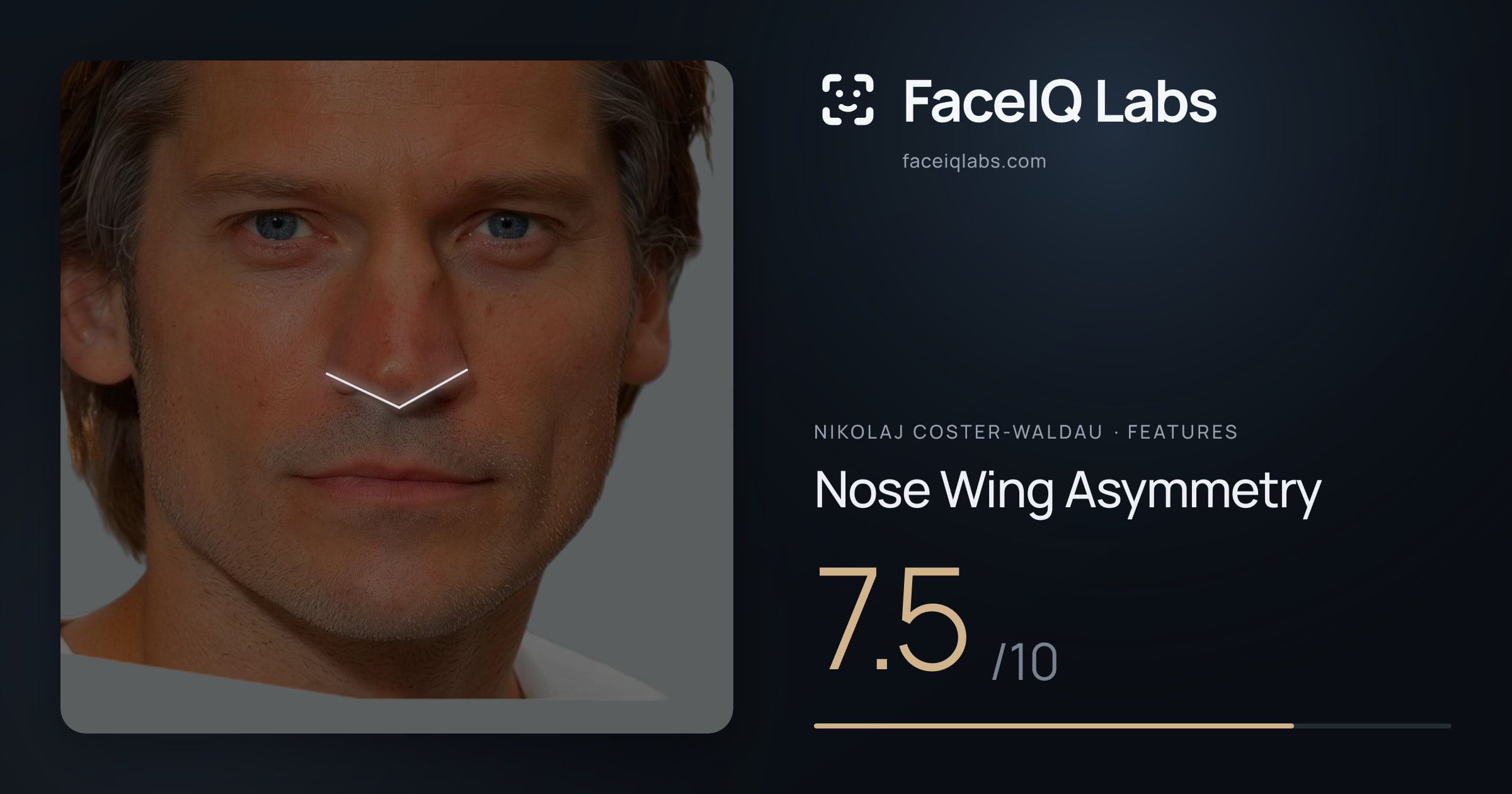 Nikolaj Coster-Waldau Nose Wing Asymmetry: 7.5/10, drawn on the photo
