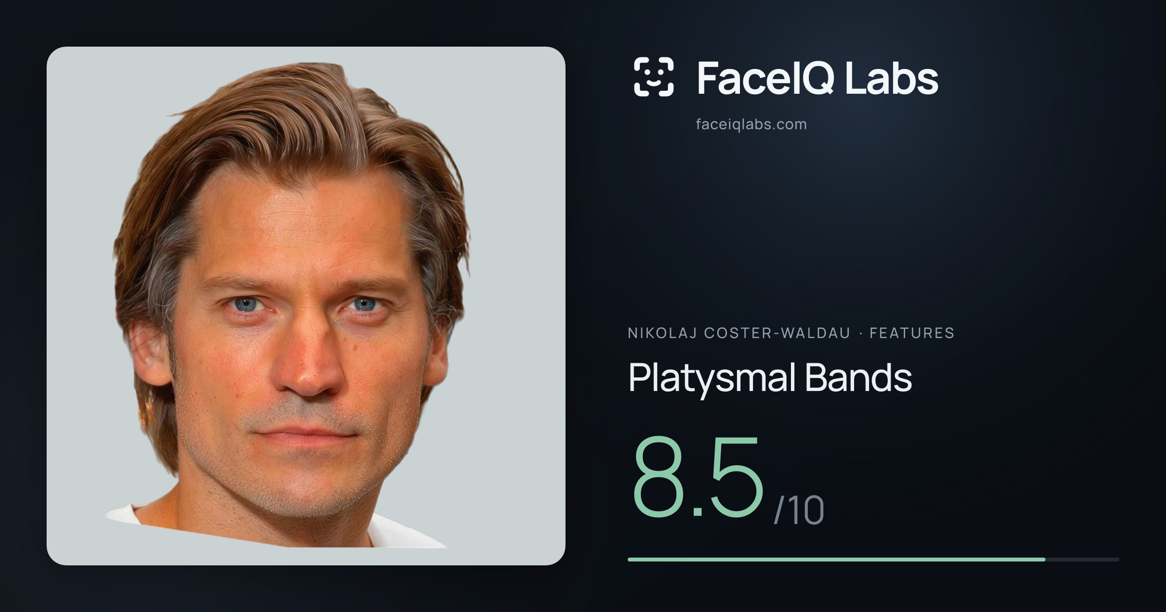 Nikolaj Coster-Waldau Platysmal Bands: 8.5/10, drawn on the photo