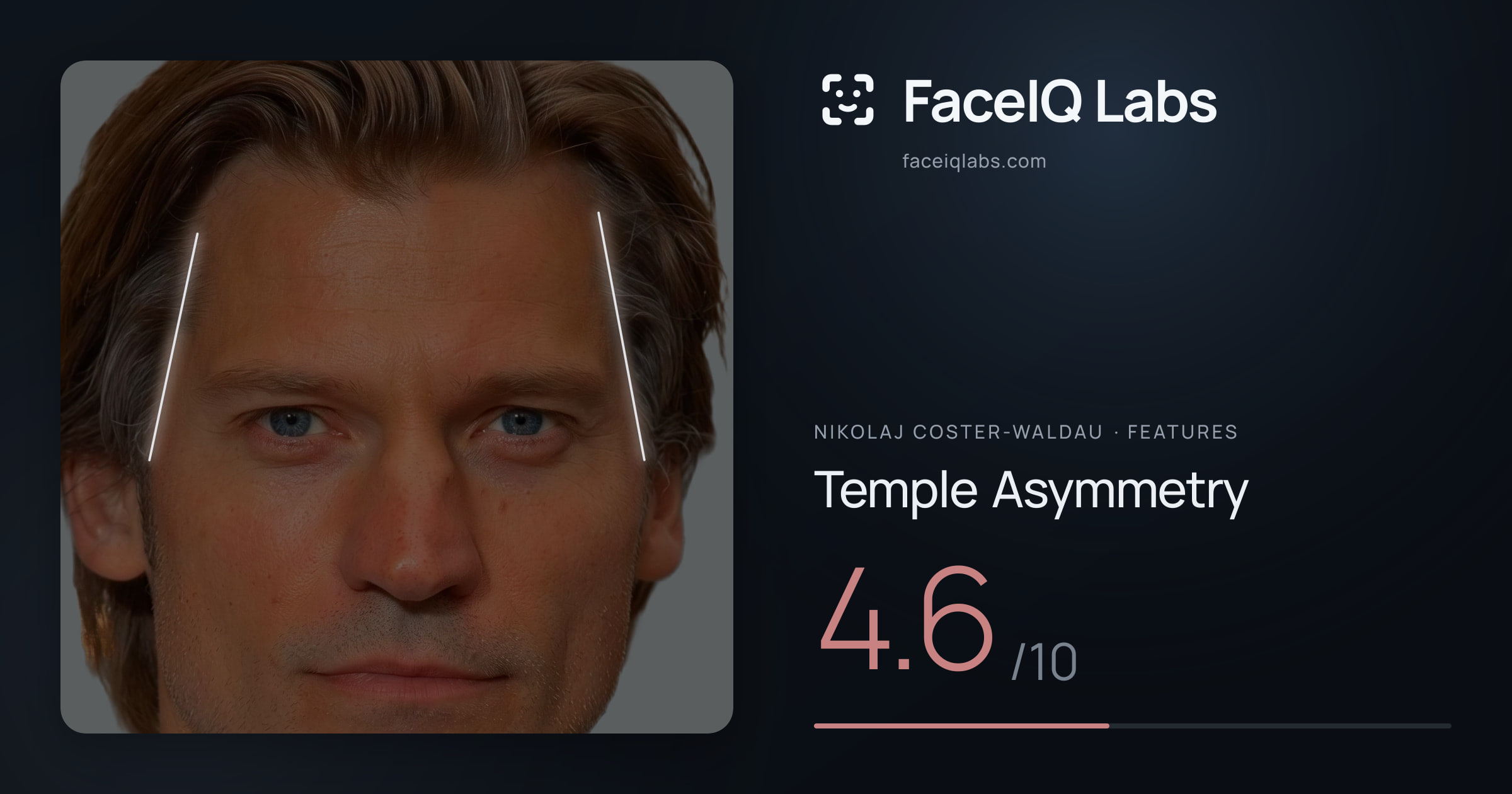 Nikolaj Coster-Waldau Temple Asymmetry: 4.6/10, drawn on the photo