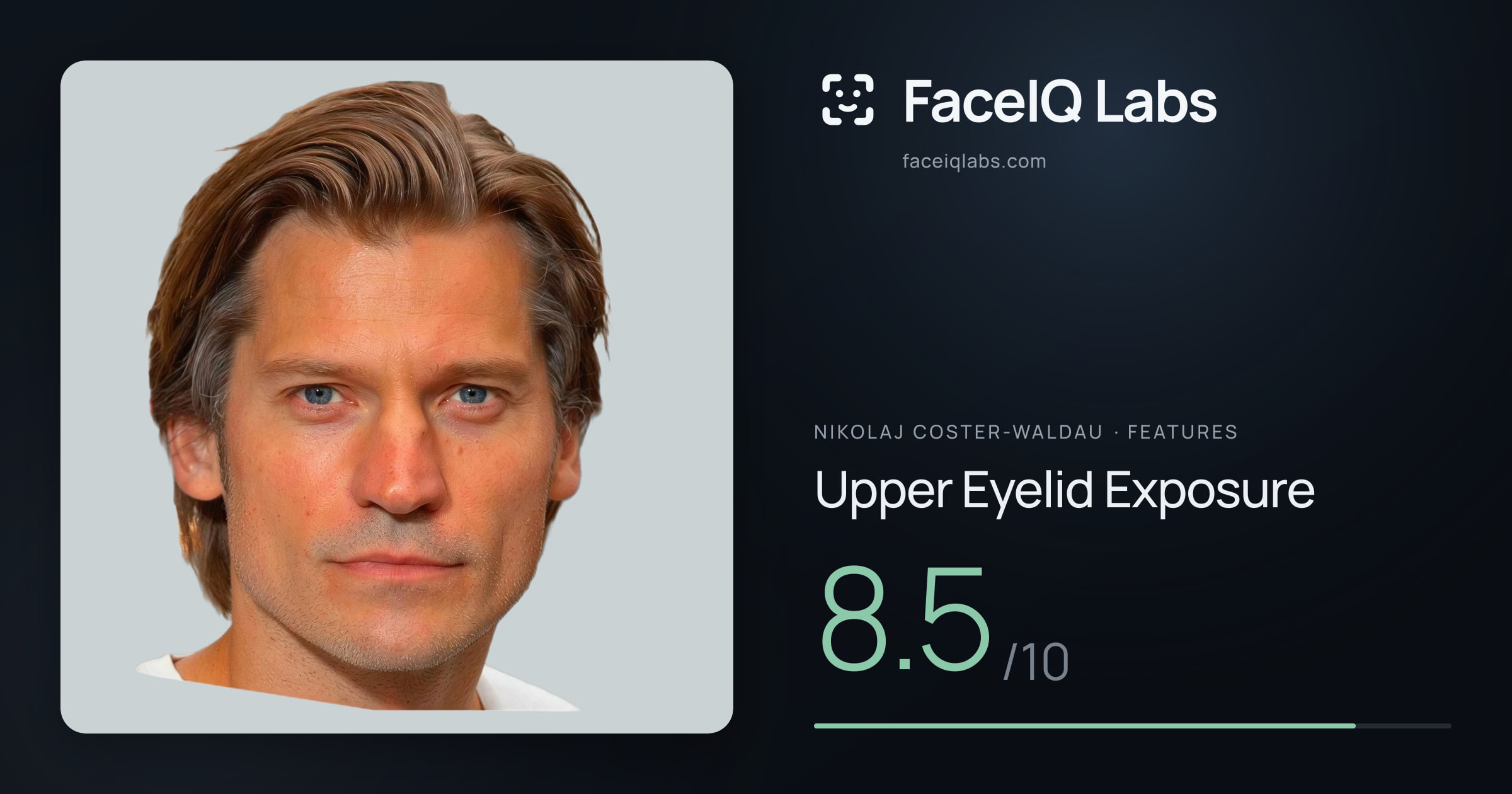 Nikolaj Coster-Waldau Upper Eyelid Exposure: 8.5/10, drawn on the photo