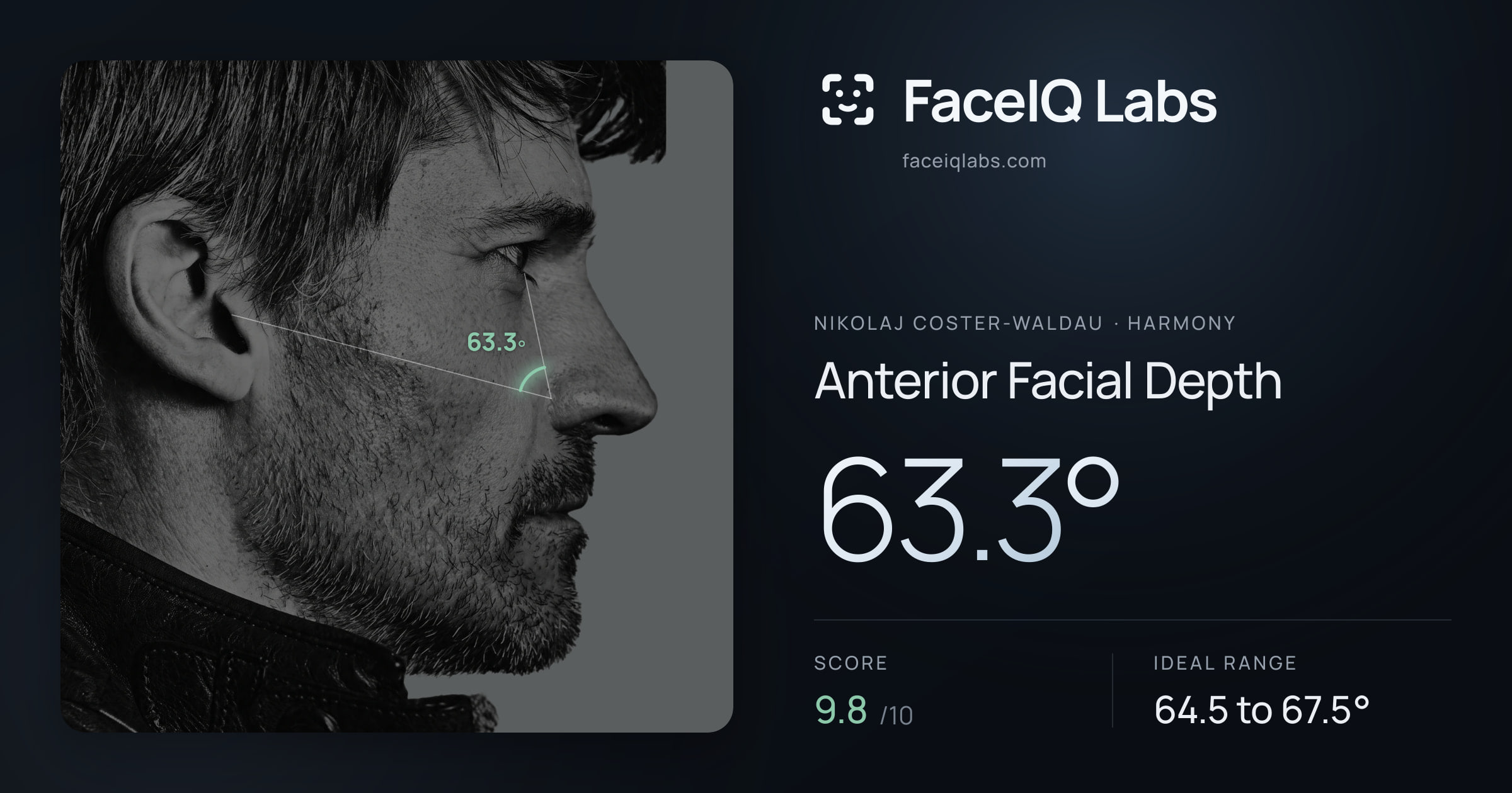 Nikolaj Coster-Waldau Anterior Facial Depth: 63.3°, drawn on the photo