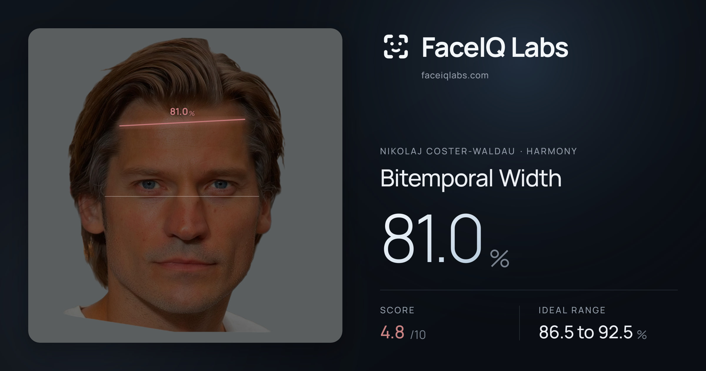 Nikolaj Coster-Waldau Bitemporal Width: 81.0%, drawn on the photo
