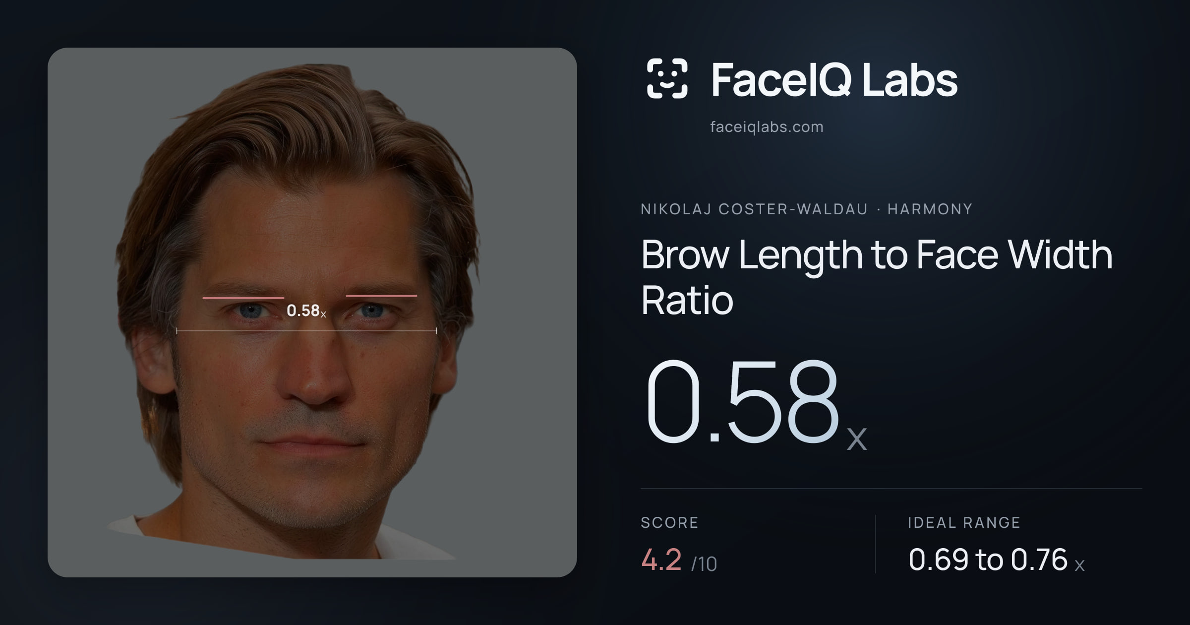 Nikolaj Coster-Waldau Brow Length to Face Width Ratio: 0.58x, drawn on the photo
