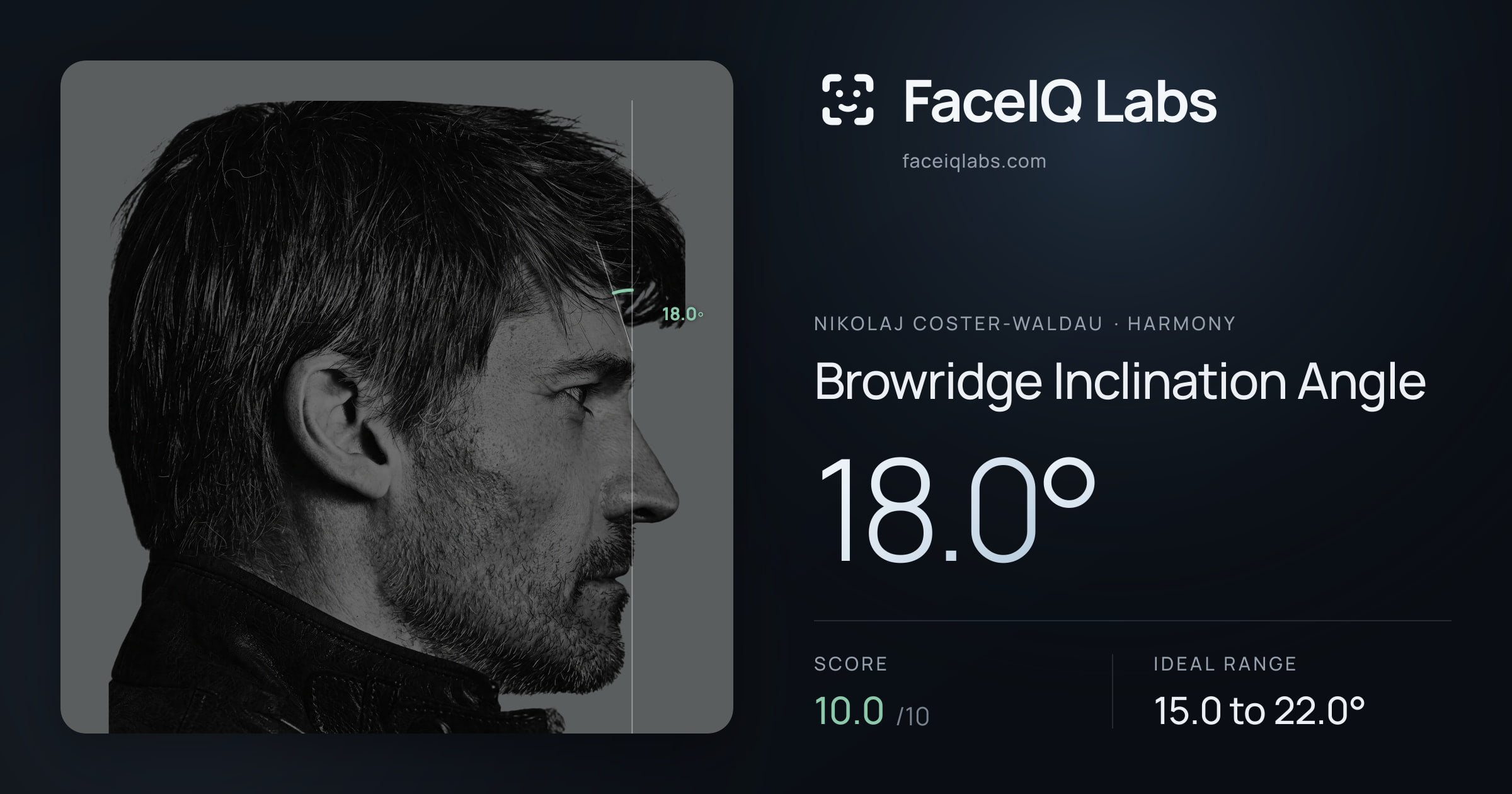 Nikolaj Coster-Waldau Browridge Inclination Angle: 18.0°, drawn on the photo