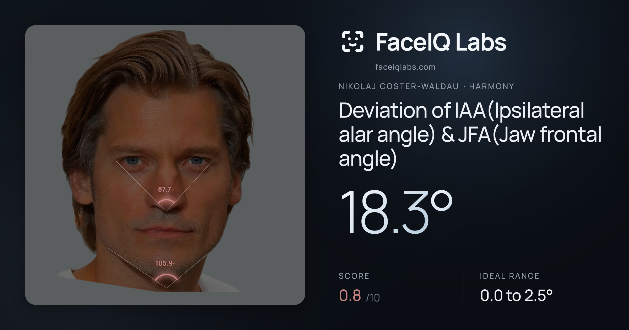 Nikolaj Coster-Waldau Deviation of IAA(Ipsilateral alar angle) & JFA(Jaw frontal angle): 18.3°, drawn on the photo