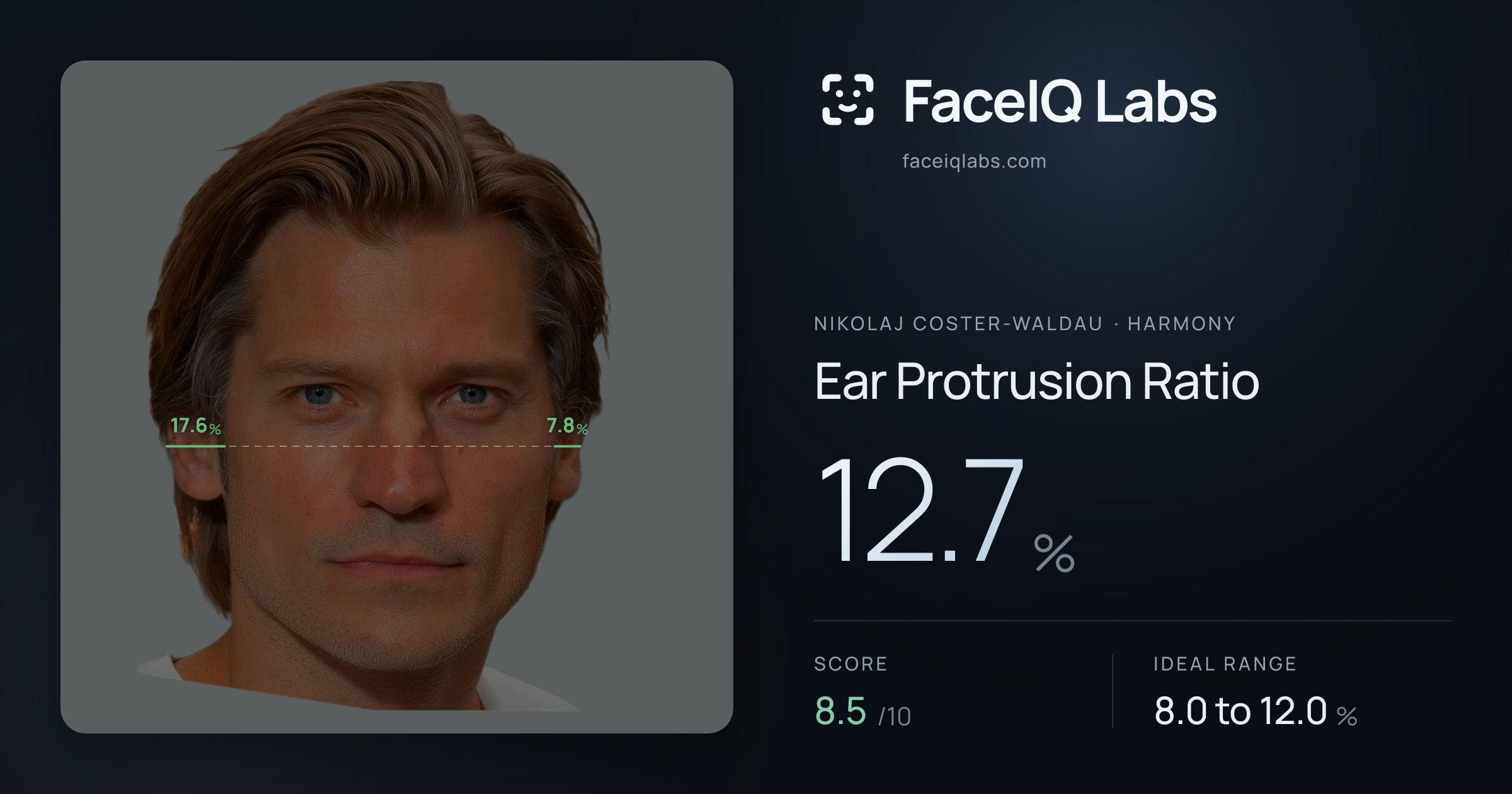 Nikolaj Coster-Waldau Ear Protrusion Ratio: 12.7%, drawn on the photo