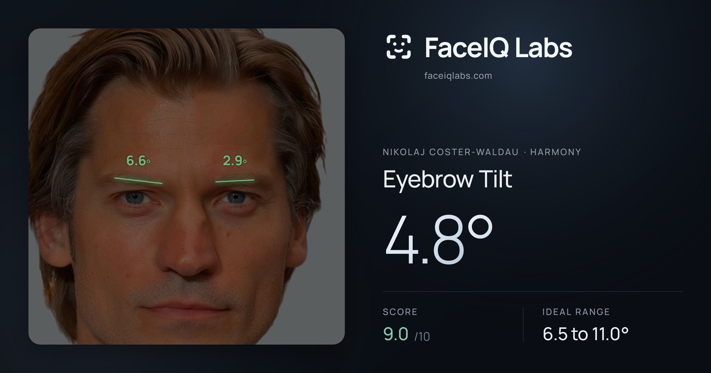 Nikolaj Coster-Waldau Eyebrow Tilt: 4.8°, drawn on the photo