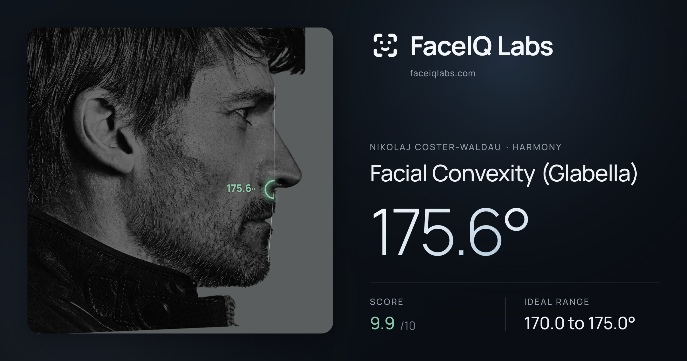 Nikolaj Coster-Waldau Facial Convexity (Glabella): 175.6°, drawn on the photo