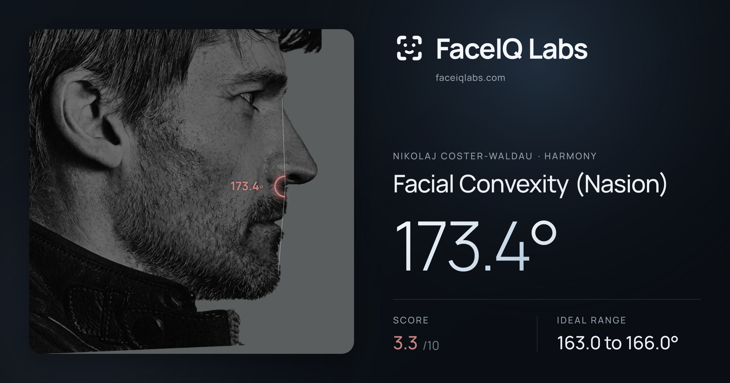 Nikolaj Coster-Waldau Facial Convexity (Nasion): 173.4°, drawn on the photo