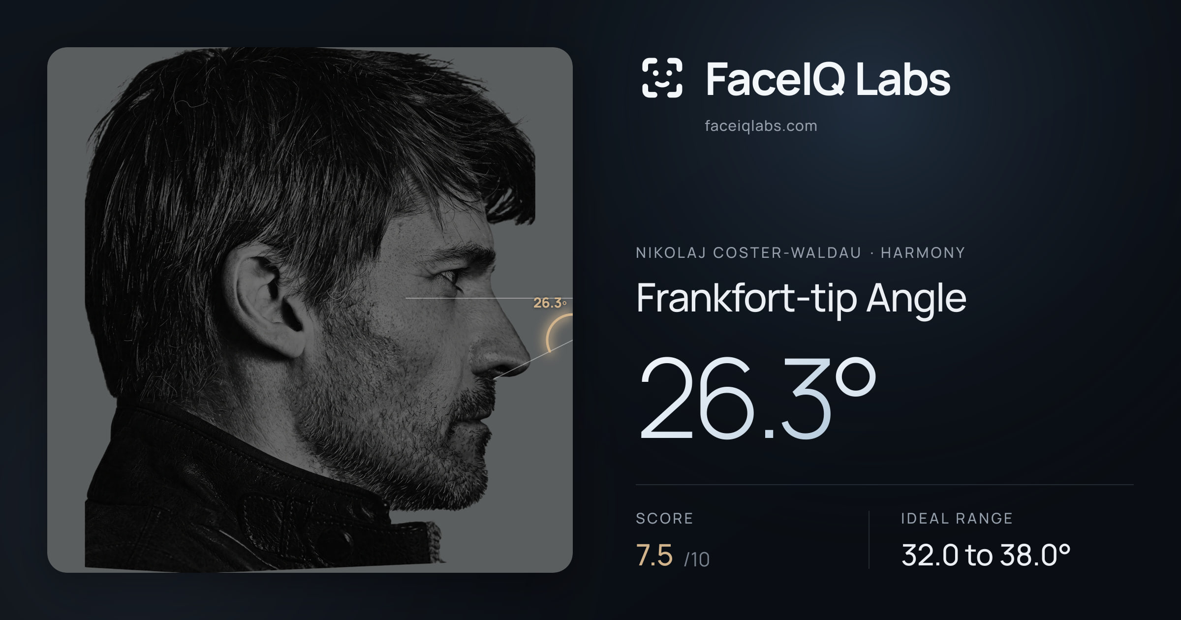 Nikolaj Coster-Waldau Frankfort-tip Angle: 26.3°, drawn on the photo