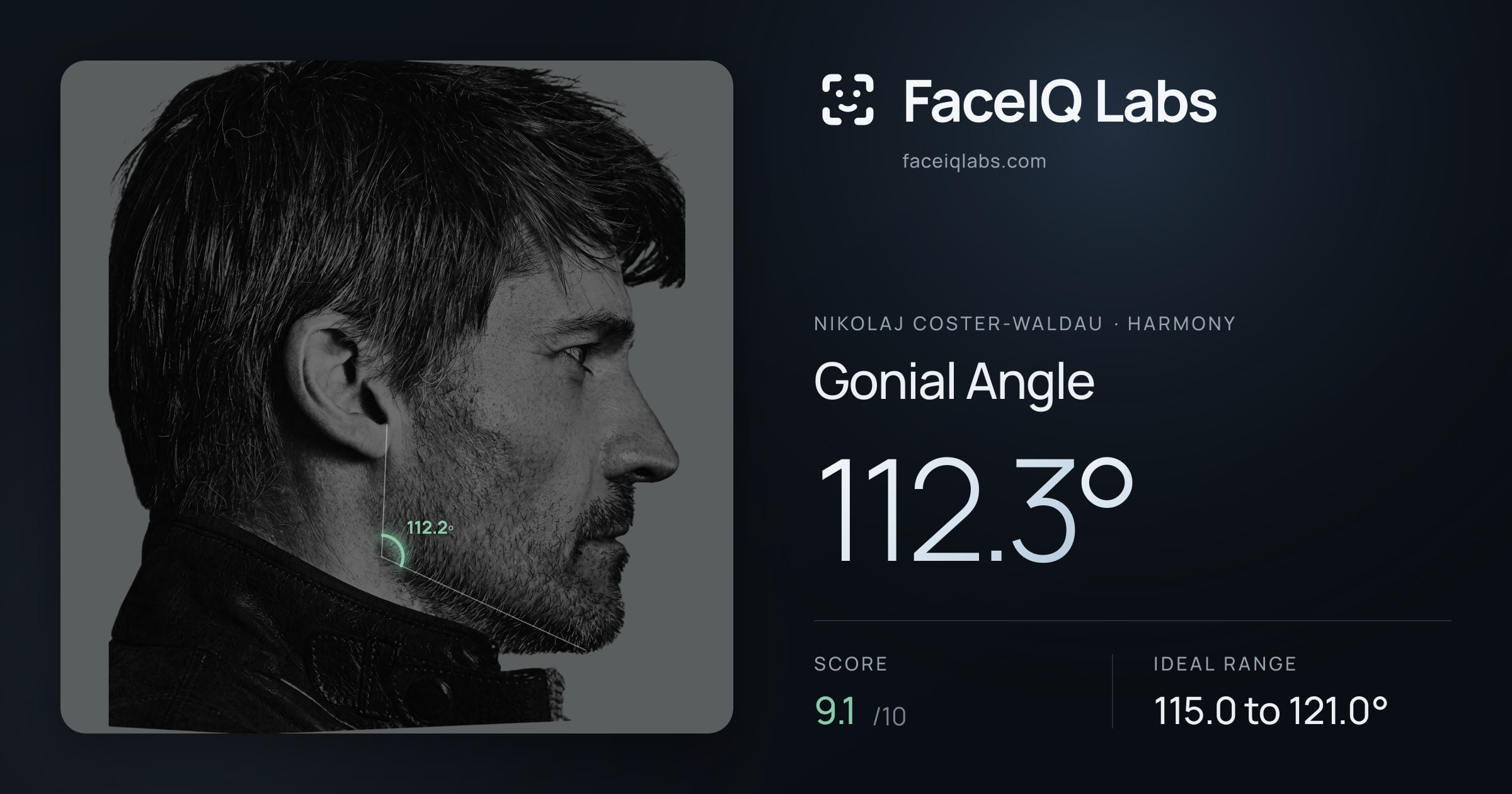 Nikolaj Coster-Waldau Gonial Angle: 112.3°, drawn on the photo