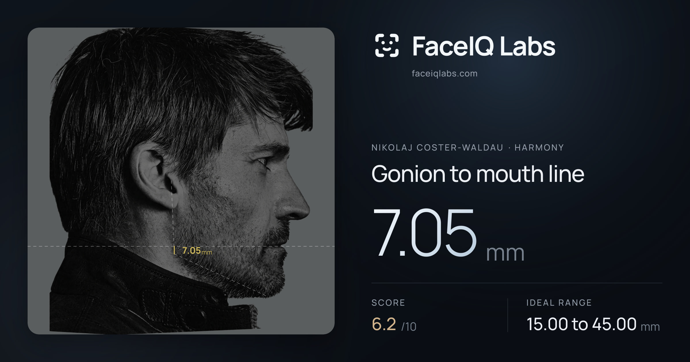 Nikolaj Coster-Waldau Gonion to mouth line: 7.05mm, drawn on the photo