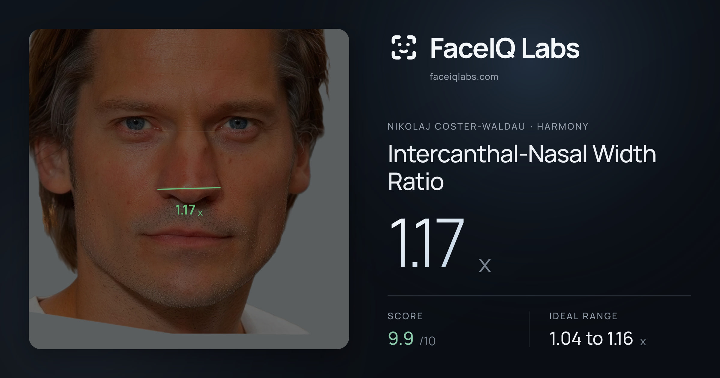 Nikolaj Coster-Waldau Intercanthal-Nasal Width Ratio: 1.17x, drawn on the photo