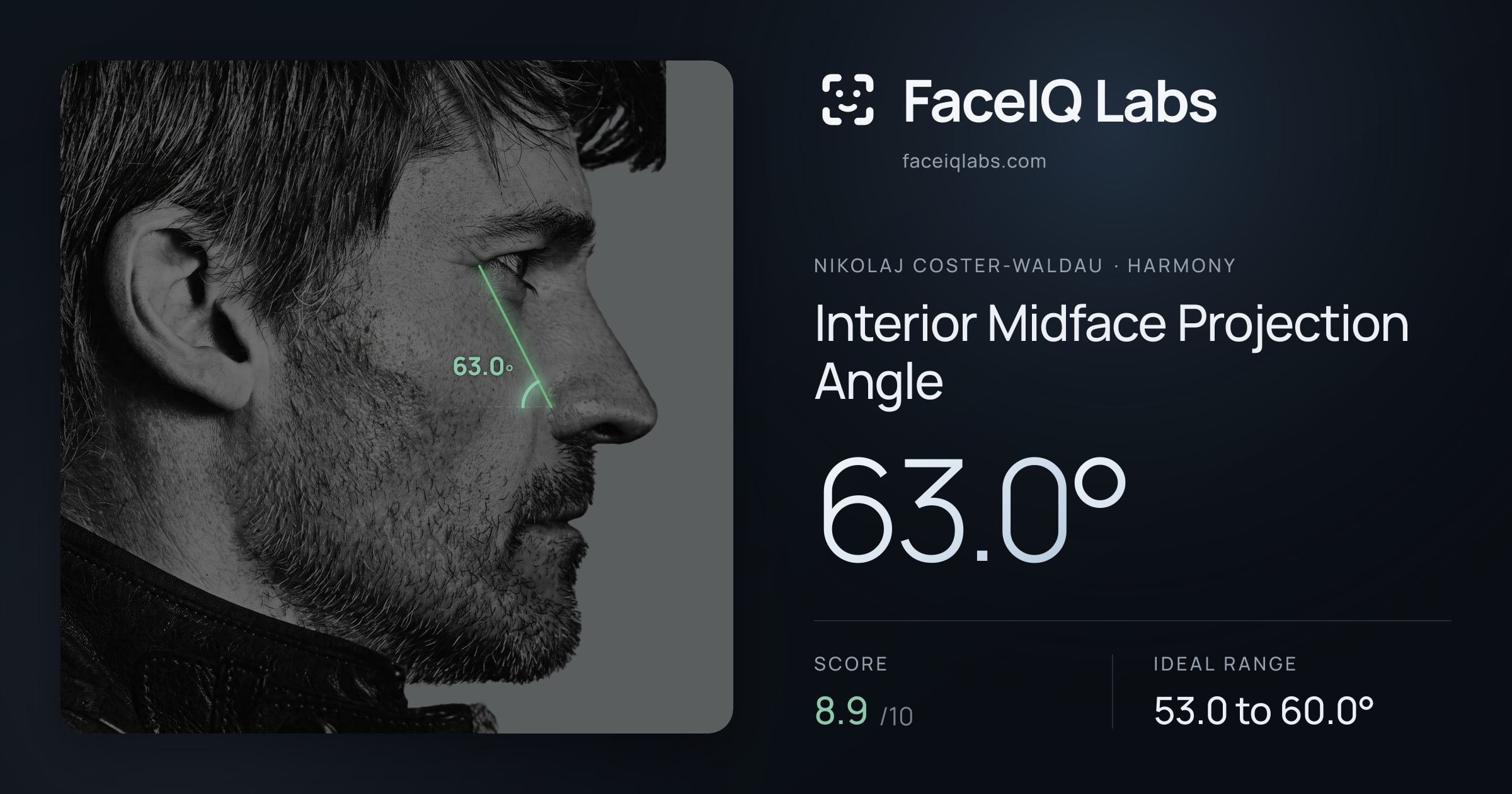 Nikolaj Coster-Waldau Interior Midface Projection Angle: 63.0°, drawn on the photo