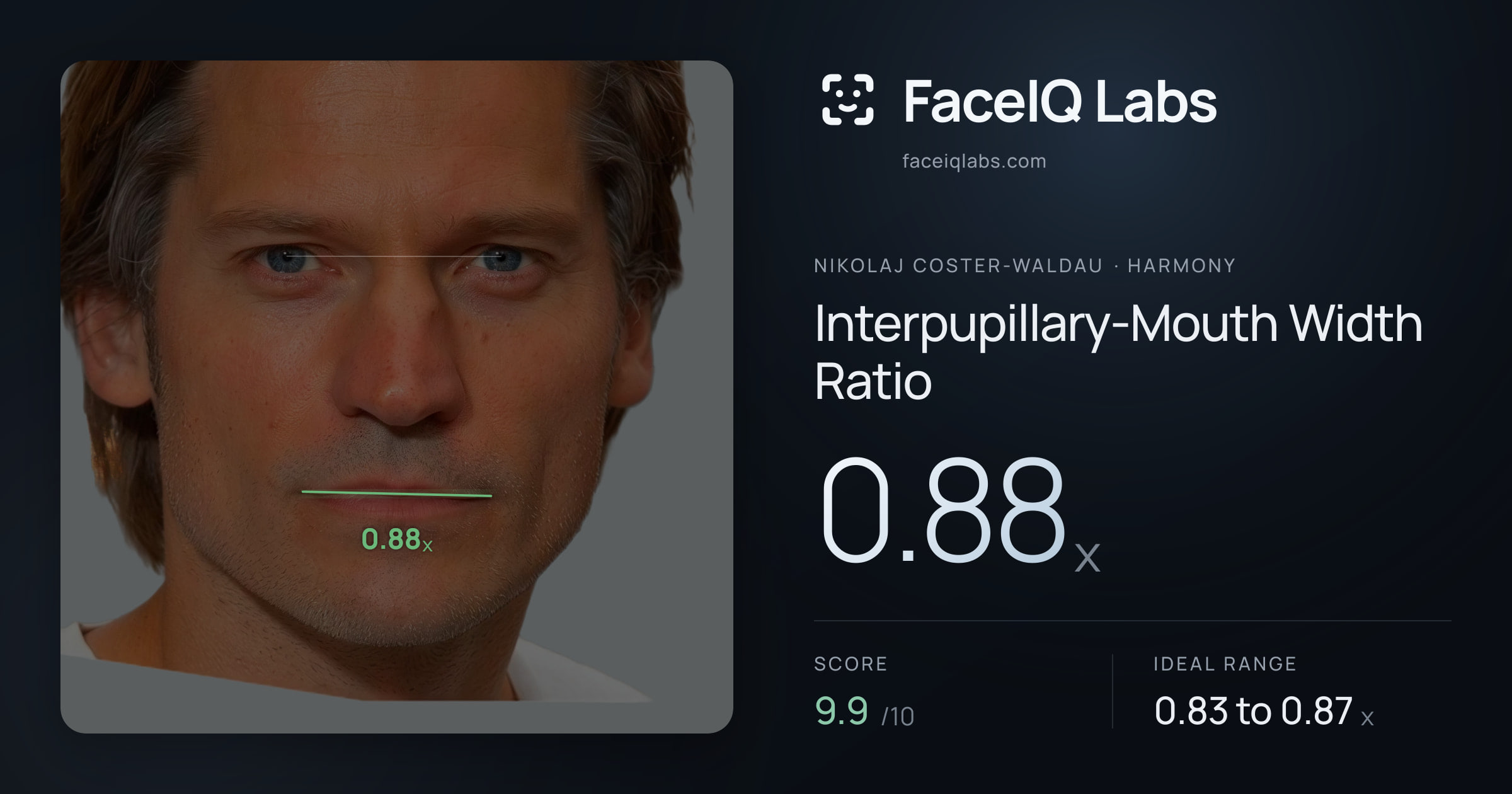 Nikolaj Coster-Waldau Interpupillary-Mouth Width Ratio: 0.88x, drawn on the photo