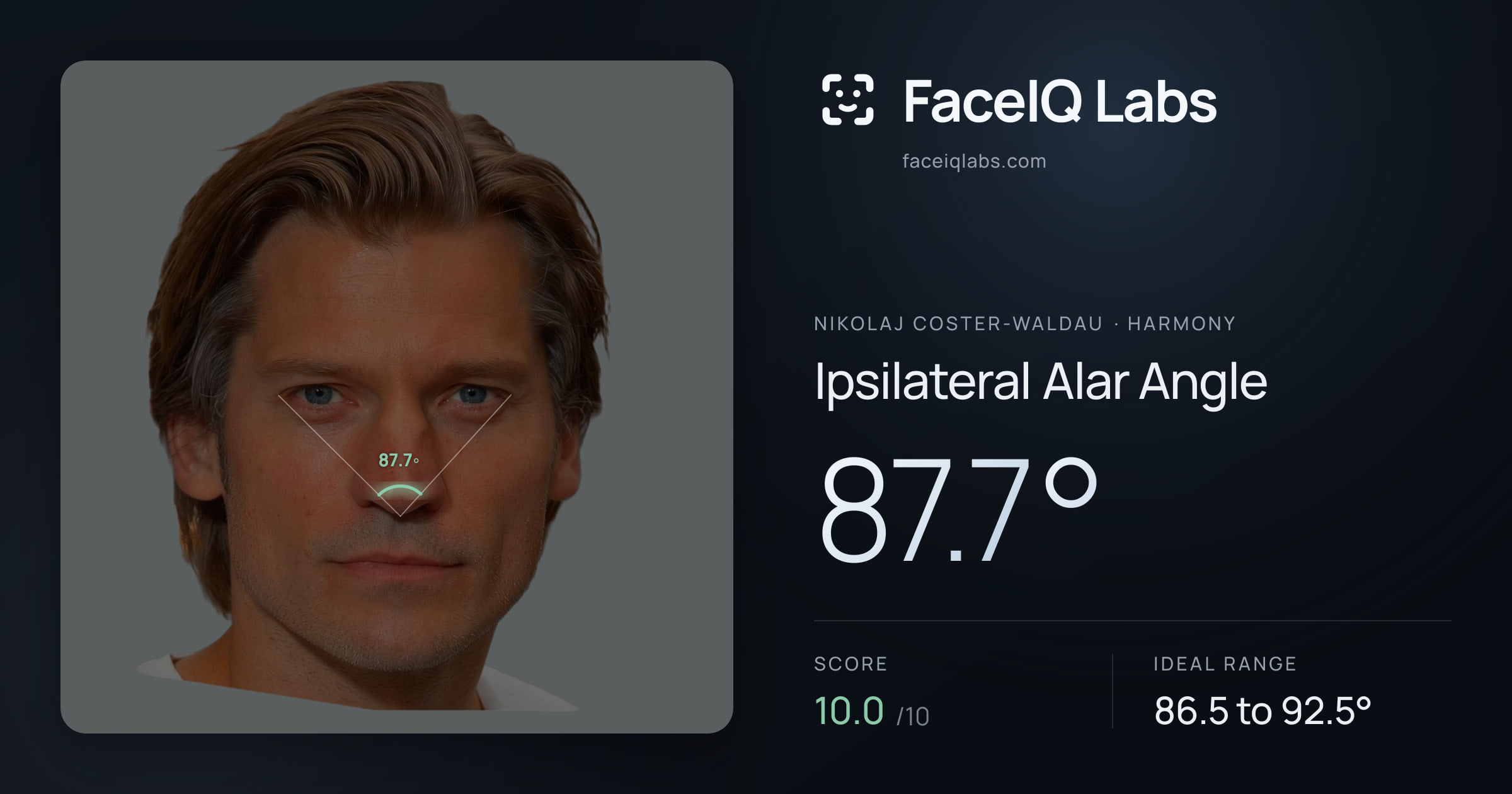 Nikolaj Coster-Waldau Ipsilateral Alar Angle: 87.7°, drawn on the photo