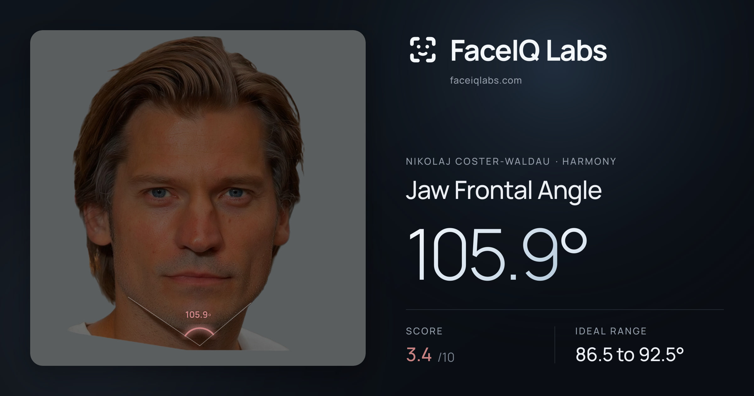 Nikolaj Coster-Waldau Jaw Frontal Angle: 105.9°, drawn on the photo
