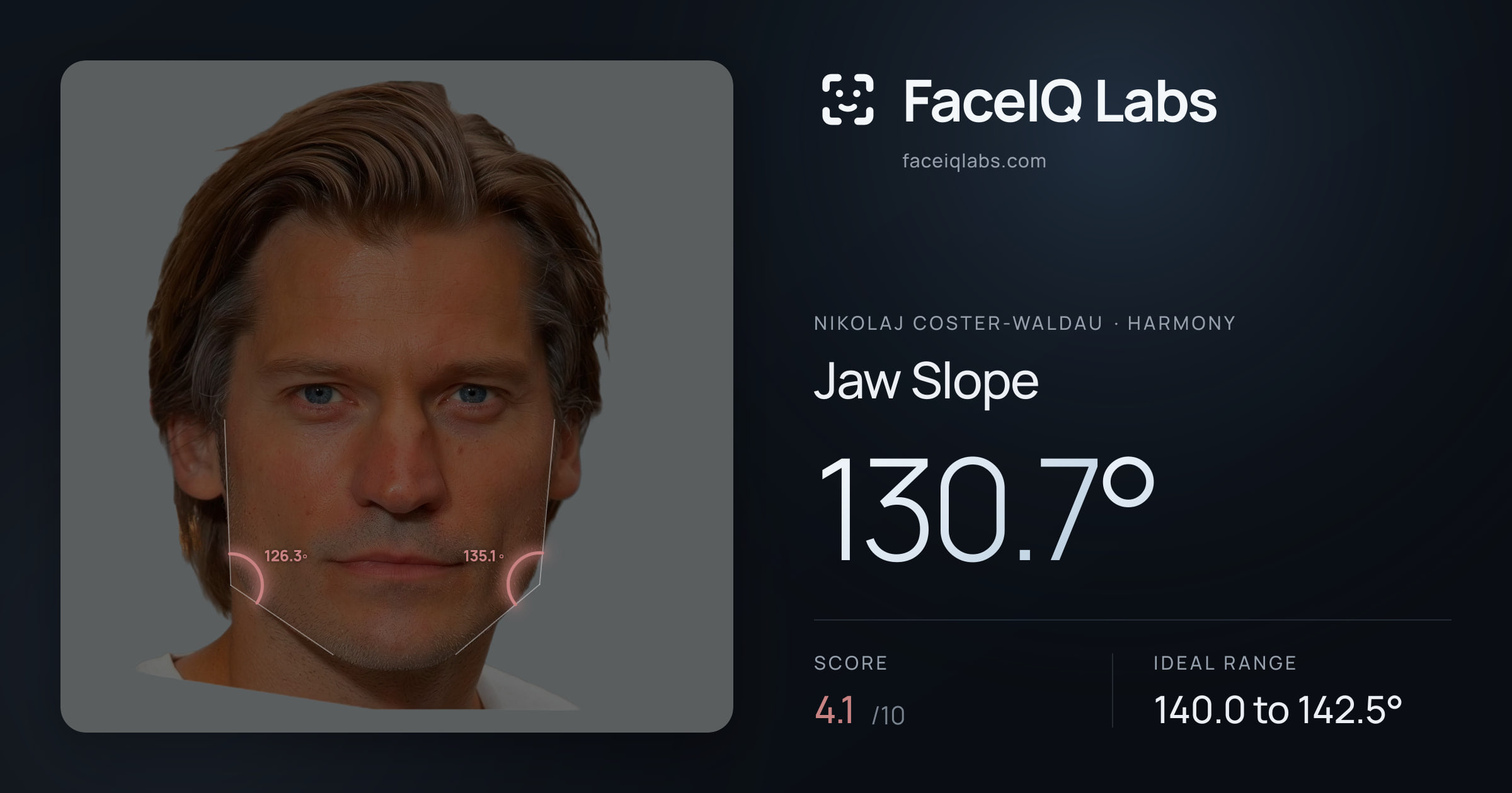 Nikolaj Coster-Waldau Jaw Slope: 130.7°, drawn on the photo