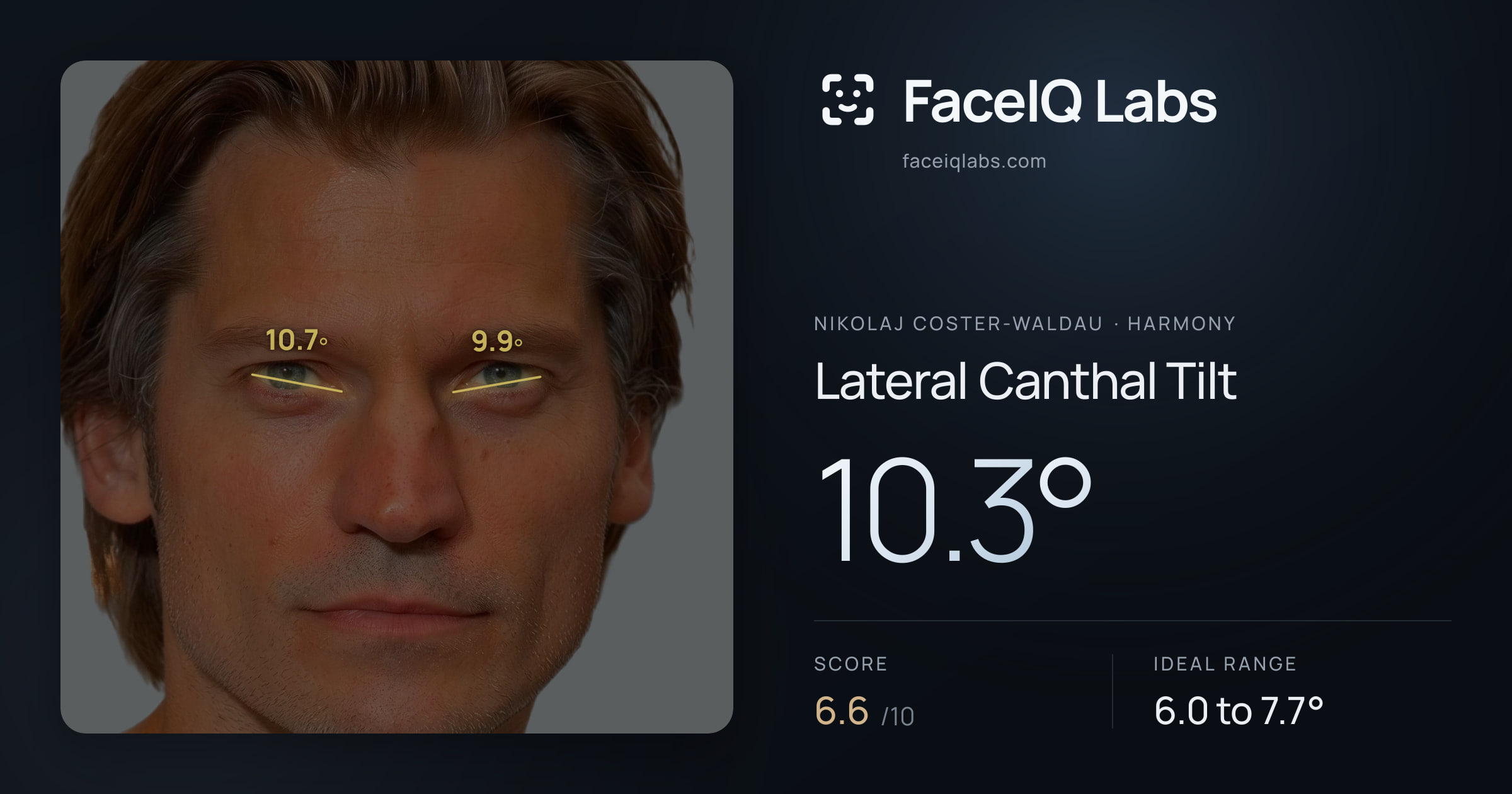 Nikolaj Coster-Waldau Lateral Canthal Tilt: 10.3°, drawn on the photo