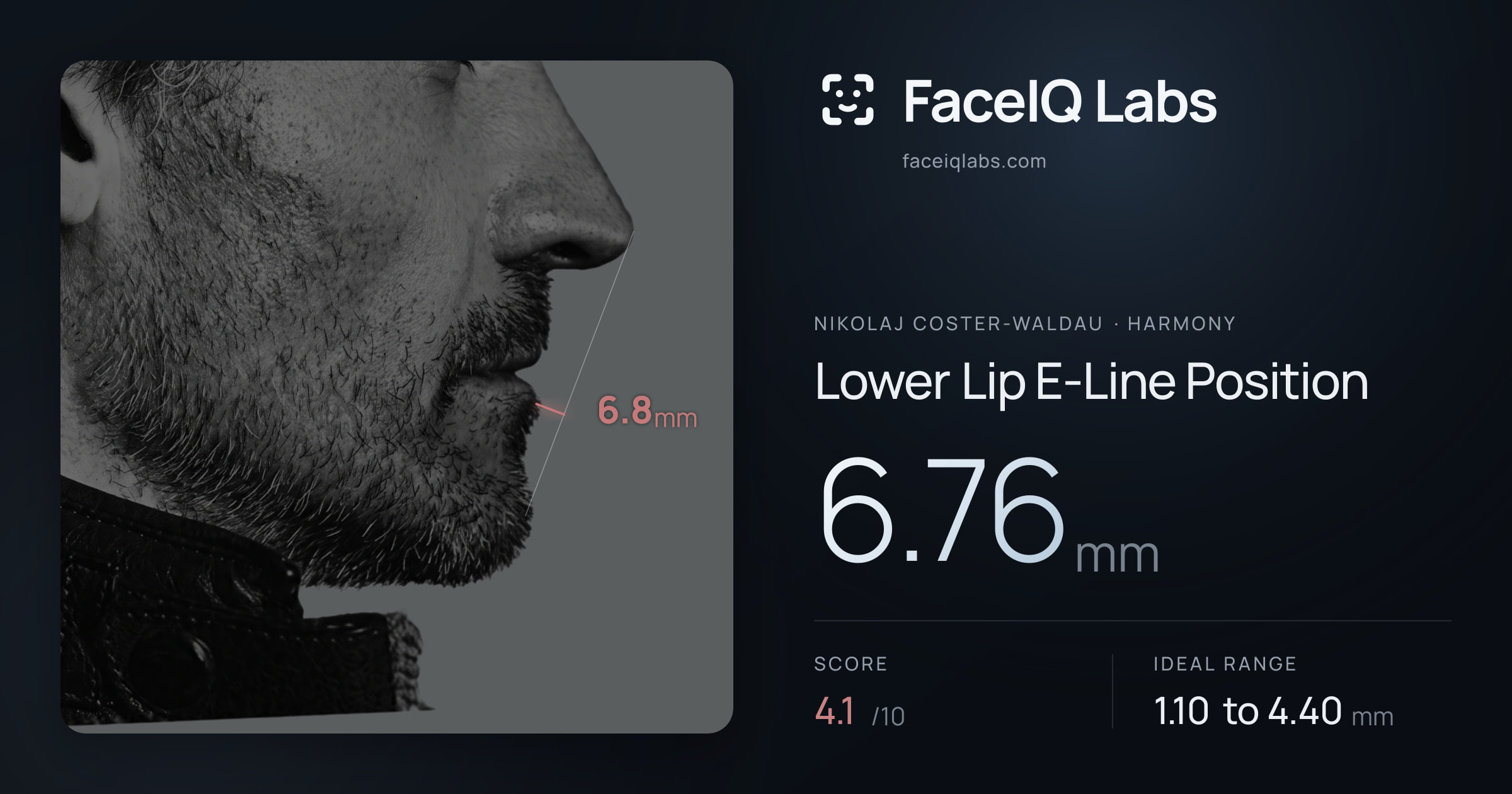 Nikolaj Coster-Waldau Lower Lip E-Line Position: 6.76mm, drawn on the photo