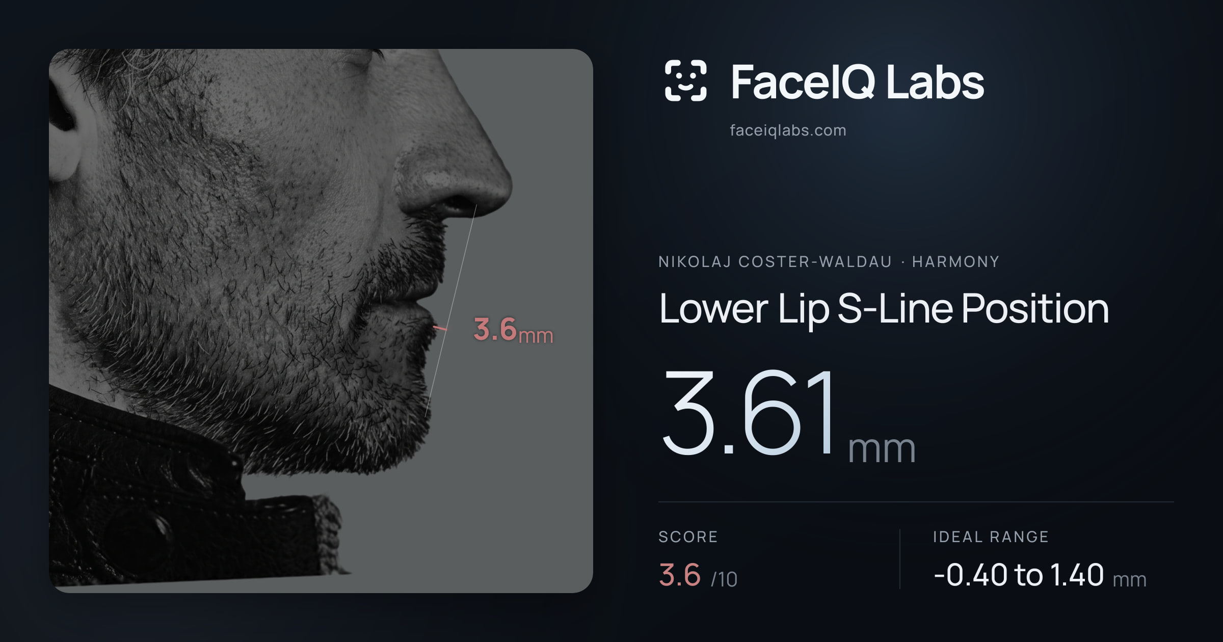 Nikolaj Coster-Waldau Lower Lip S-Line Position: 3.61mm, drawn on the photo