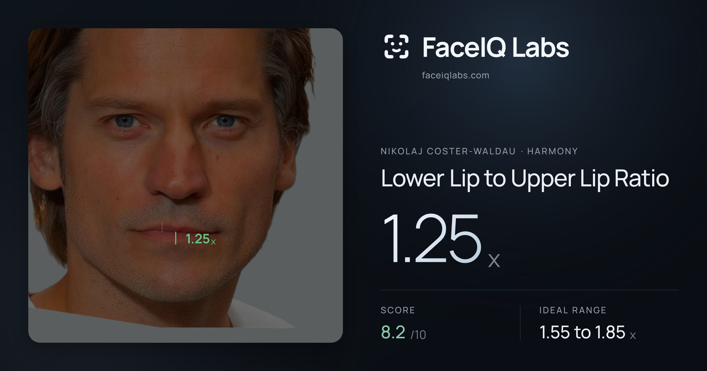 Nikolaj Coster-Waldau Lower Lip to Upper Lip Ratio: 1.25x, drawn on the photo