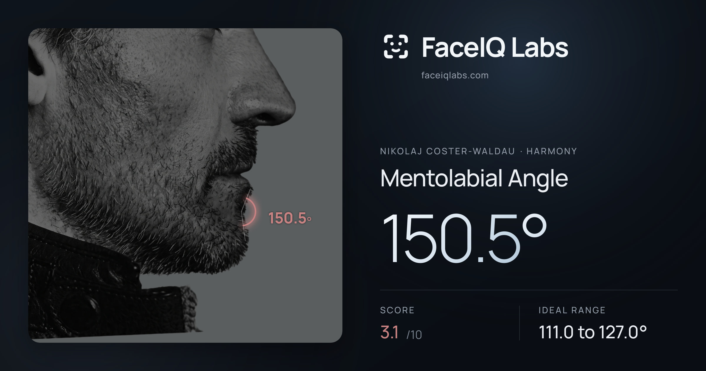 Nikolaj Coster-Waldau Mentolabial Angle: 150.5°, drawn on the photo