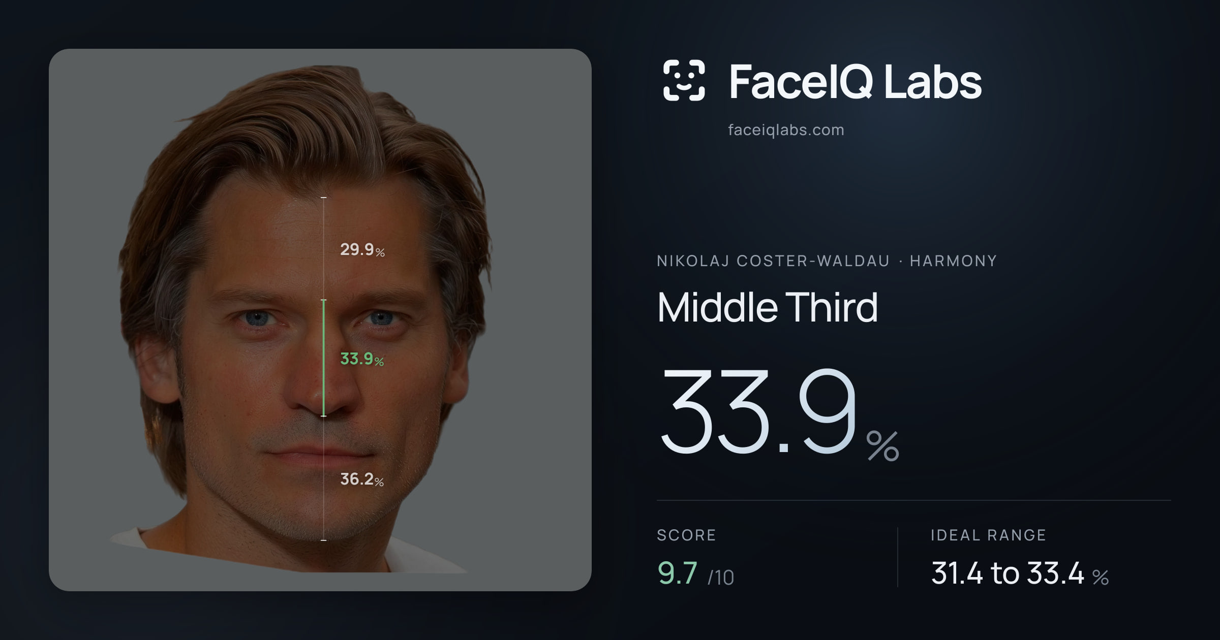 Nikolaj Coster-Waldau Middle Third: 33.9%, drawn on the photo