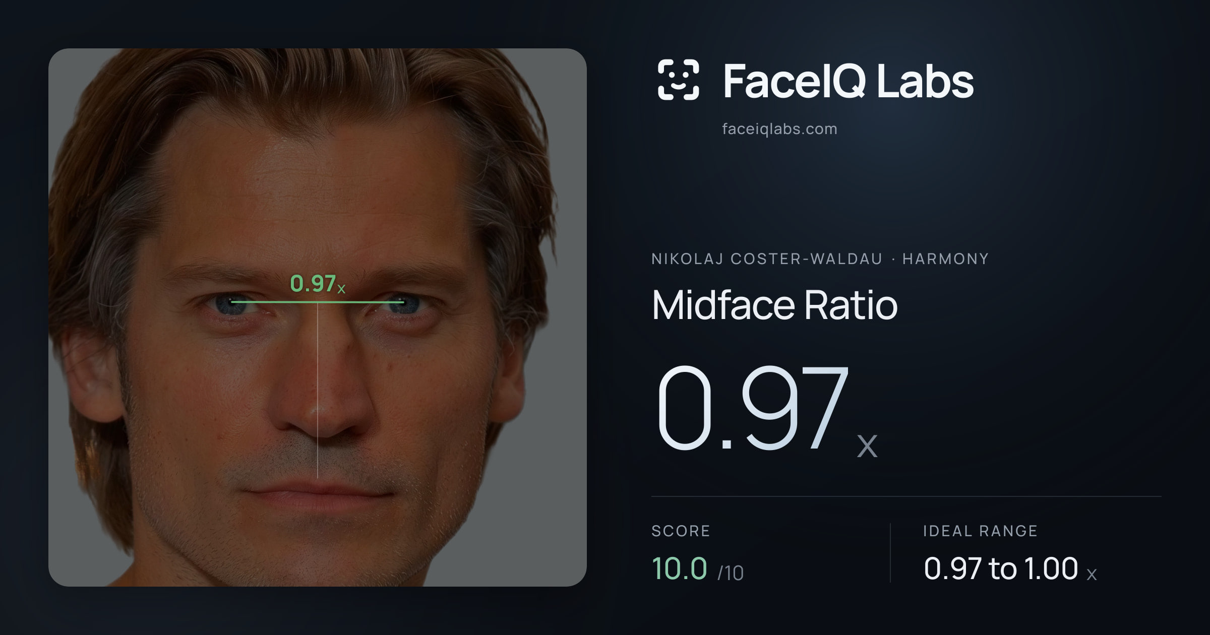 Nikolaj Coster-Waldau Midface Ratio: 0.97x, drawn on the photo