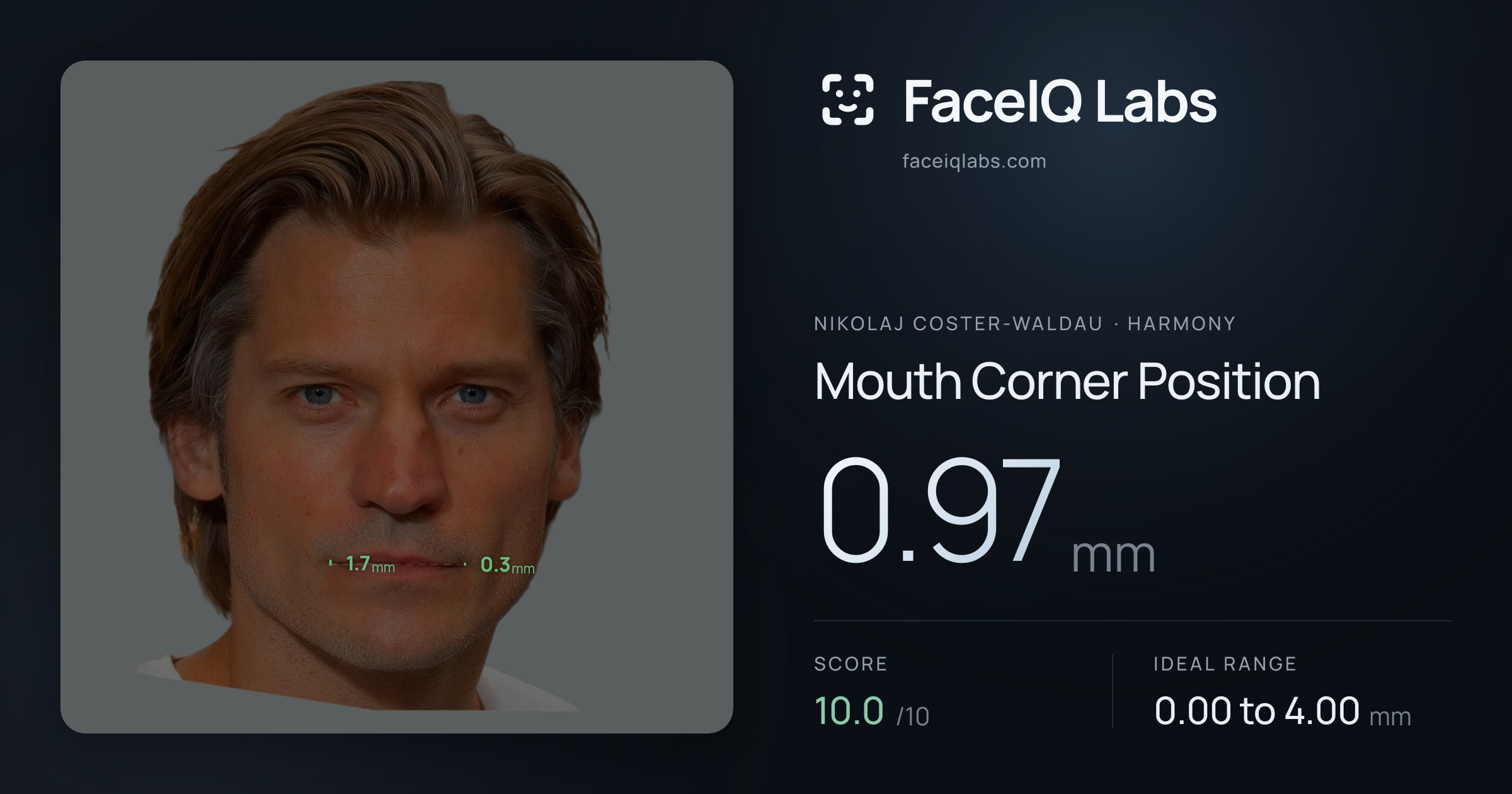 Nikolaj Coster-Waldau Mouth Corner Position: 0.97mm, drawn on the photo